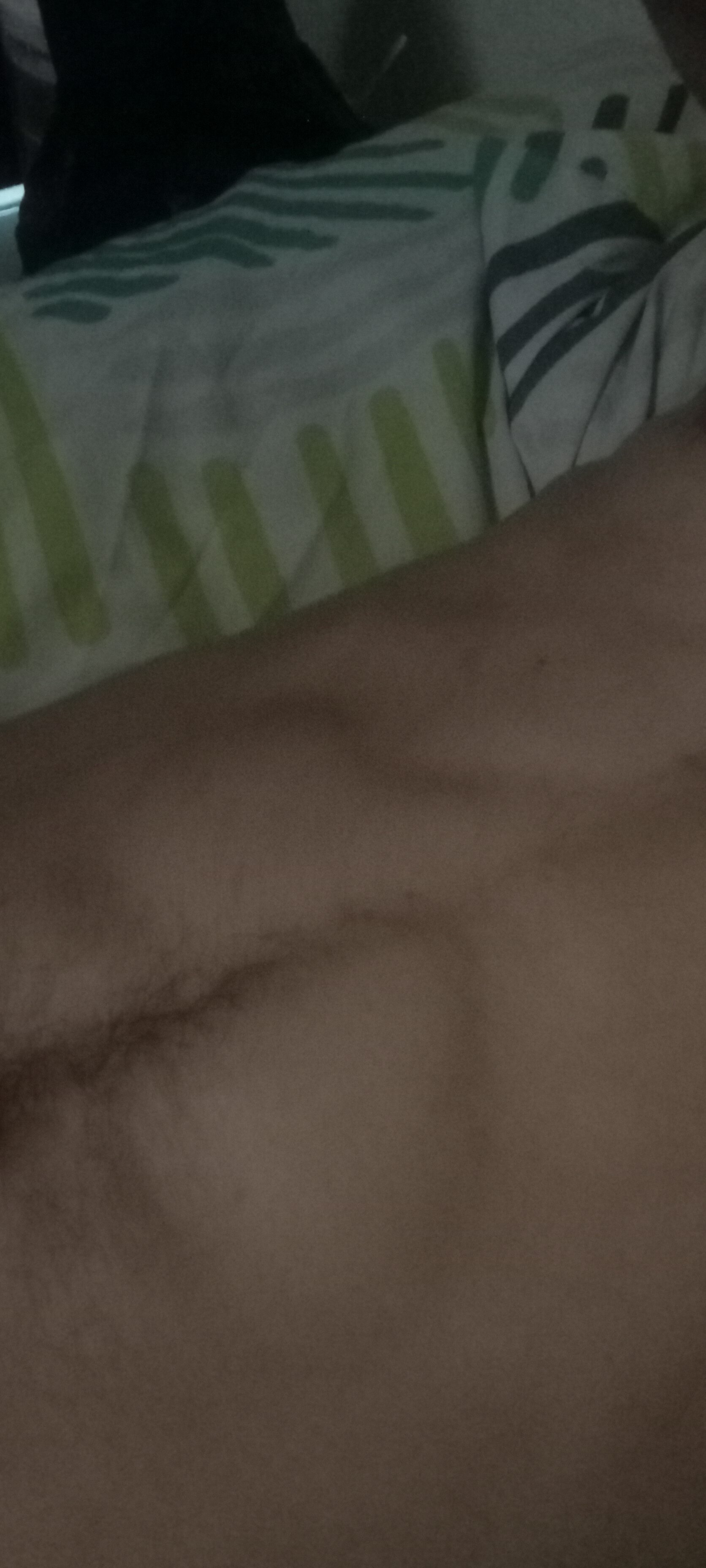 25mt