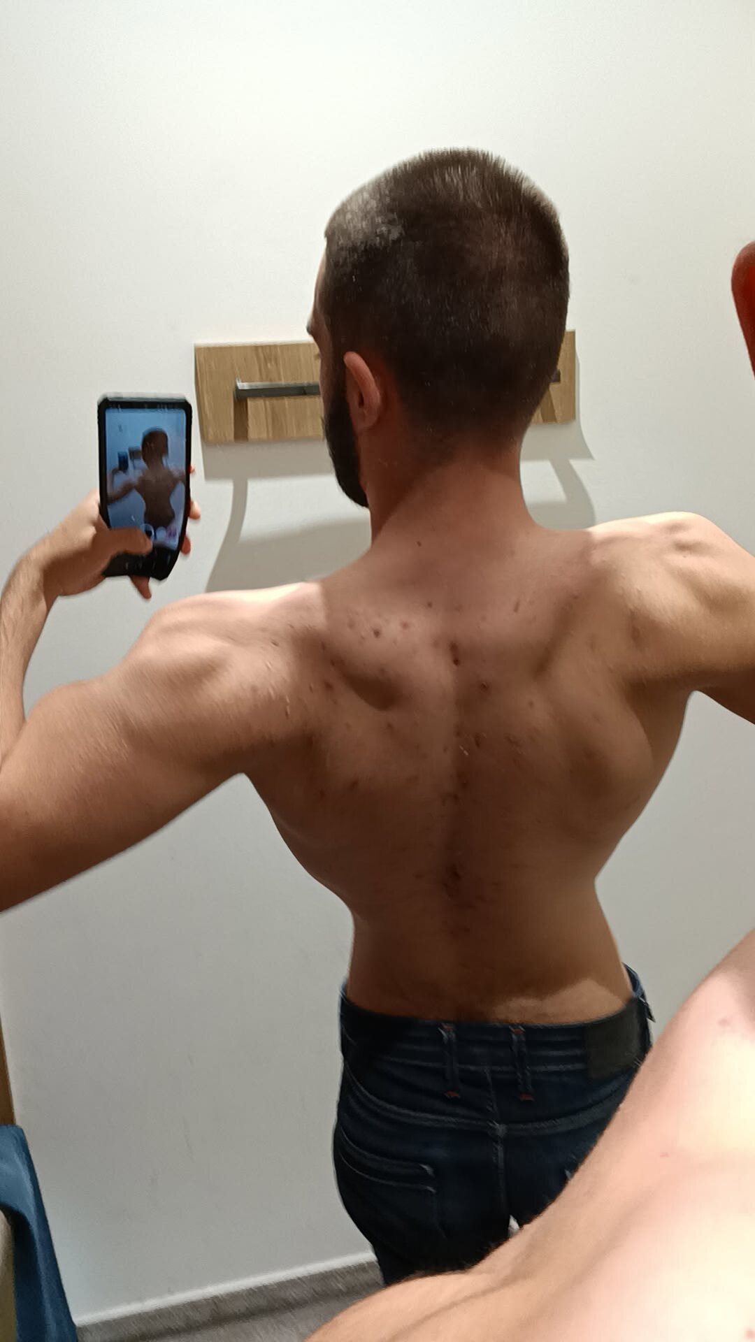 18cmwhiteboy