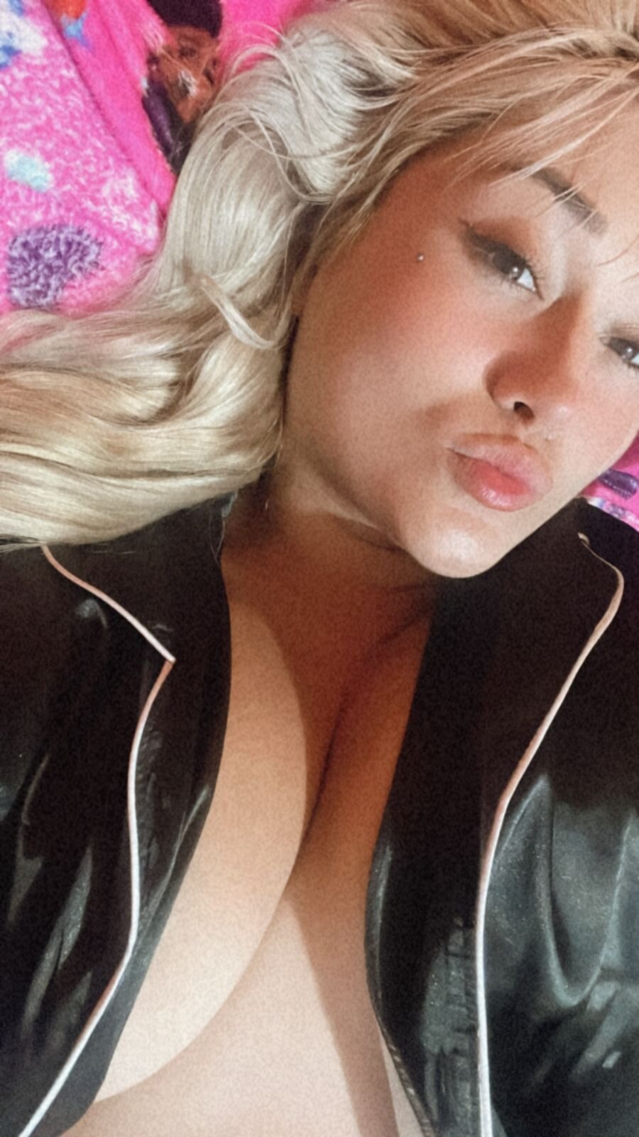 melytom