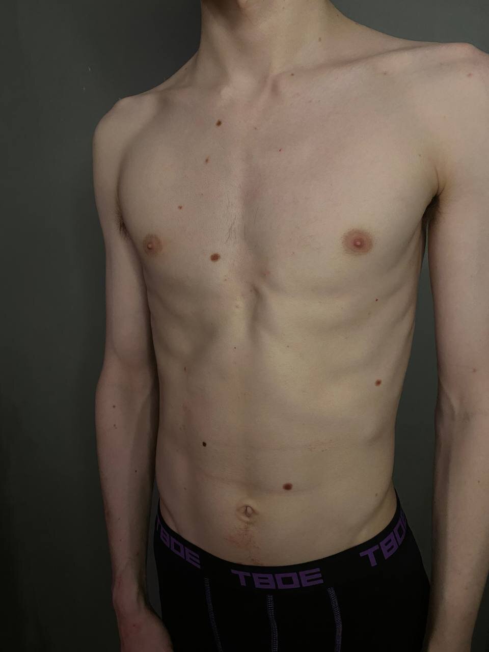 Lewis_Hartmann