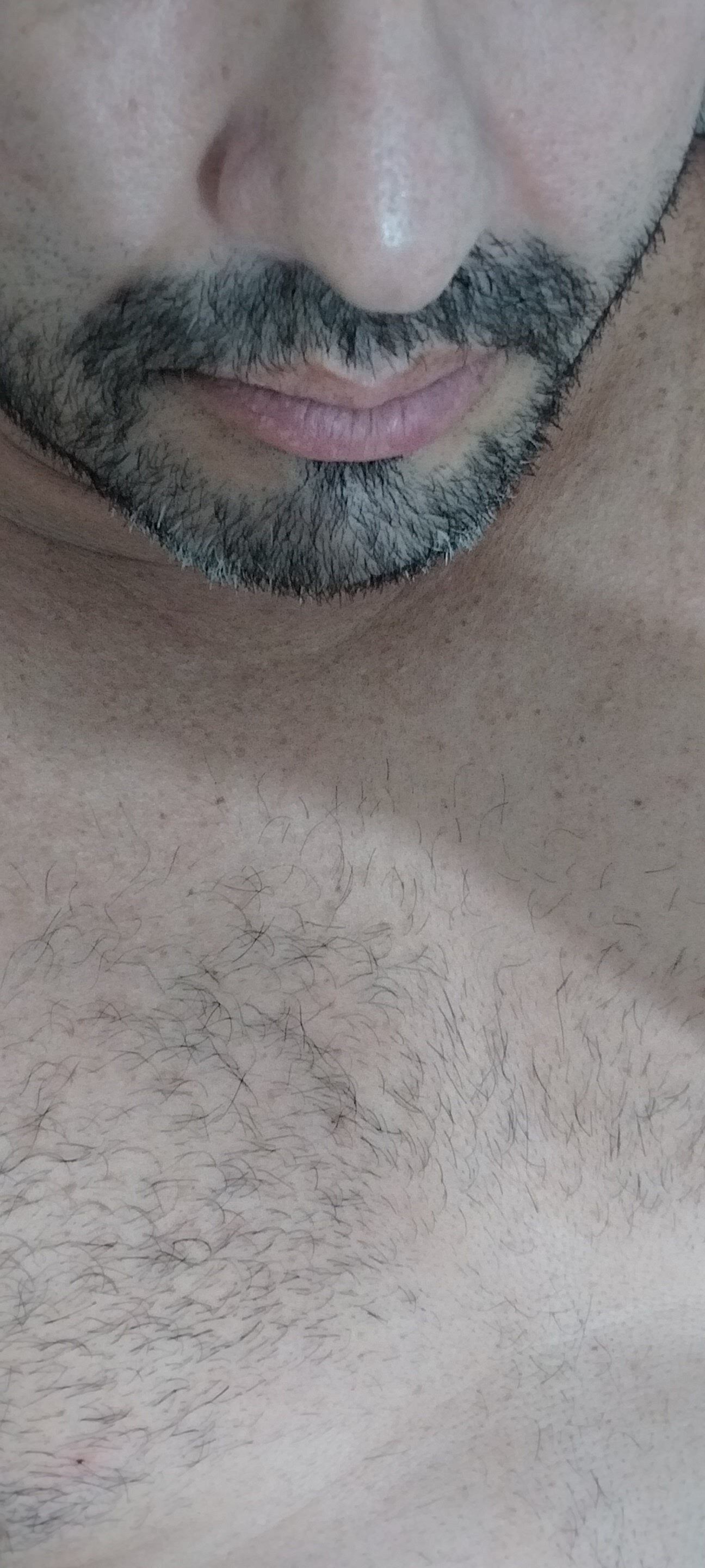 jpfig07