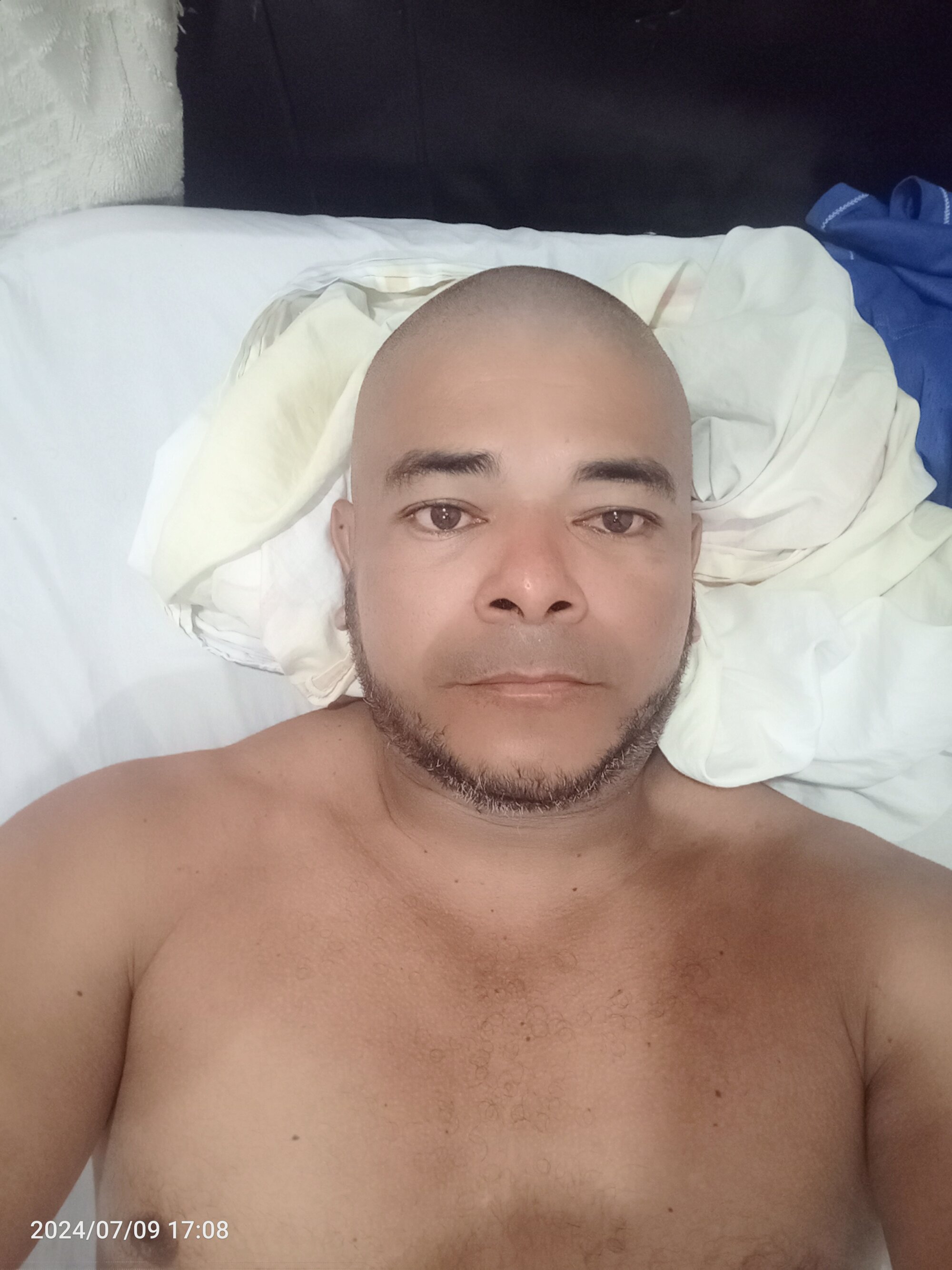 anale83