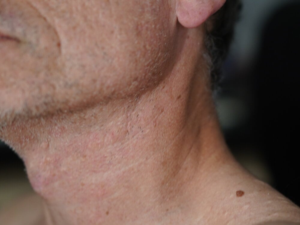 Edolan profile