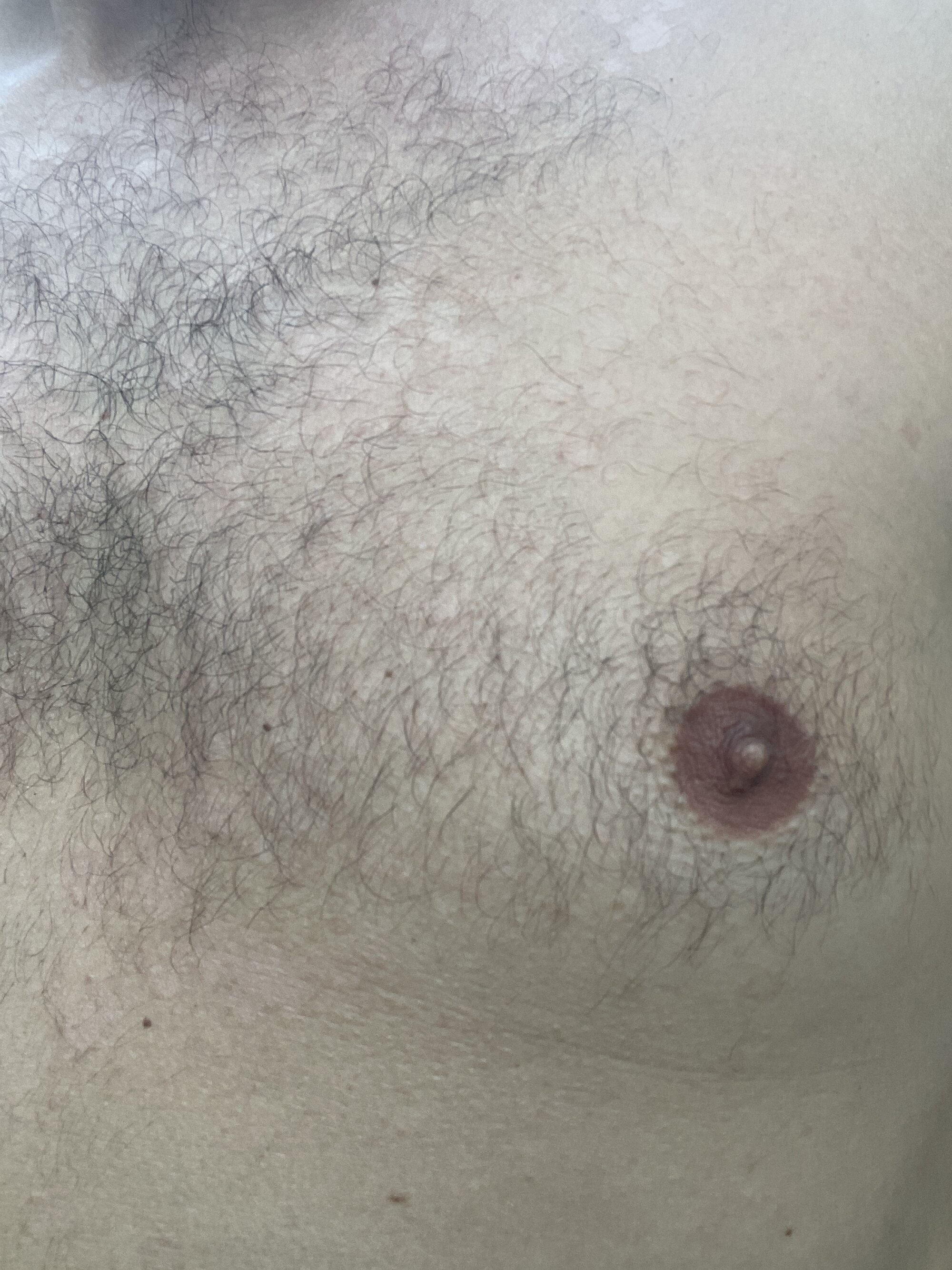 licignacio33