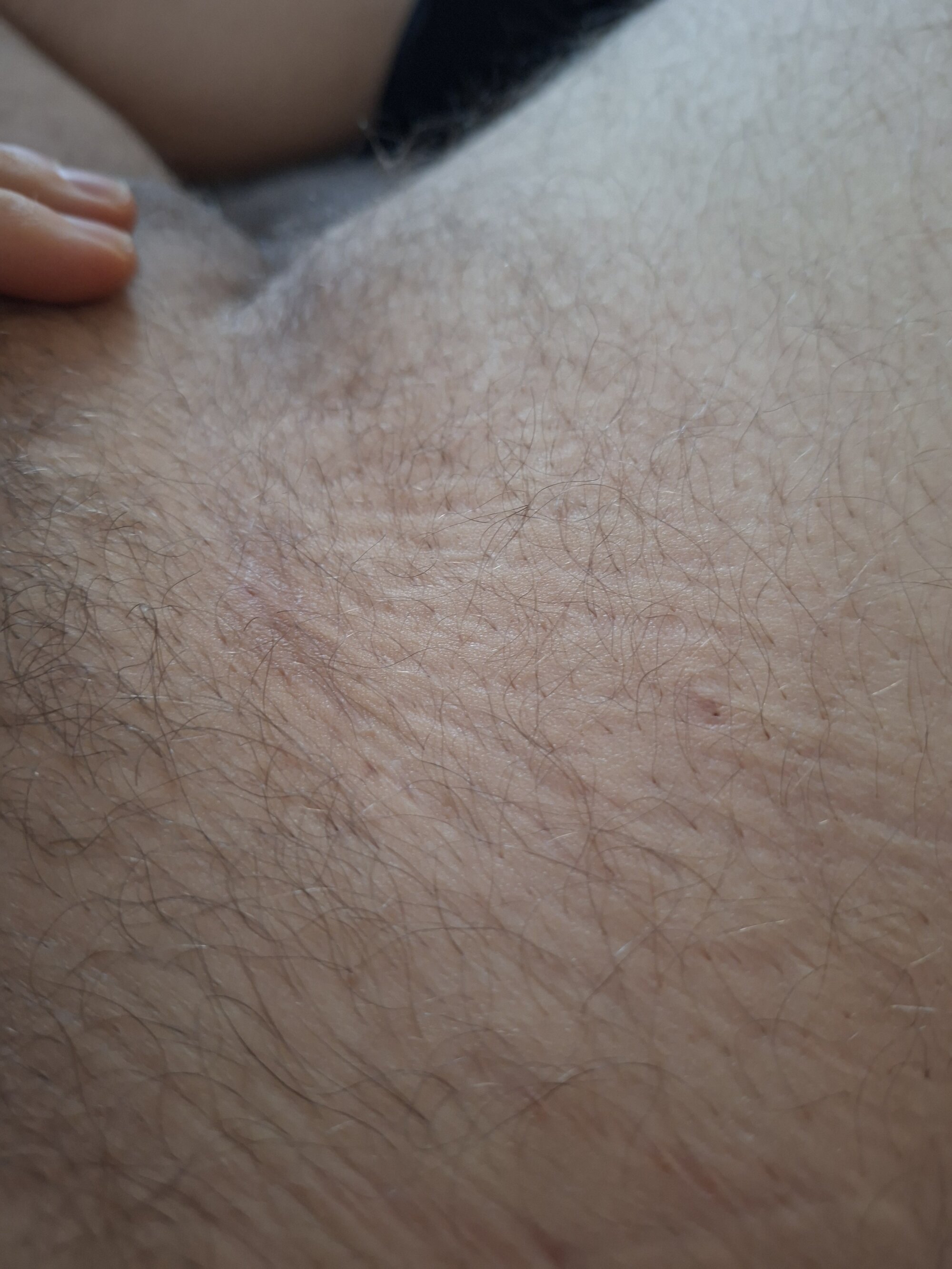 TicklingRuralism
