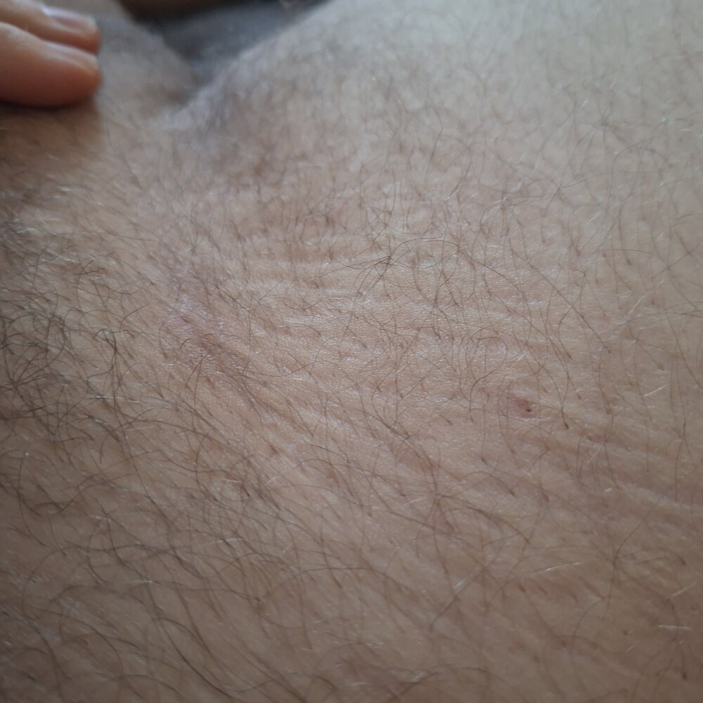 TicklingRuralism's most recent online preview