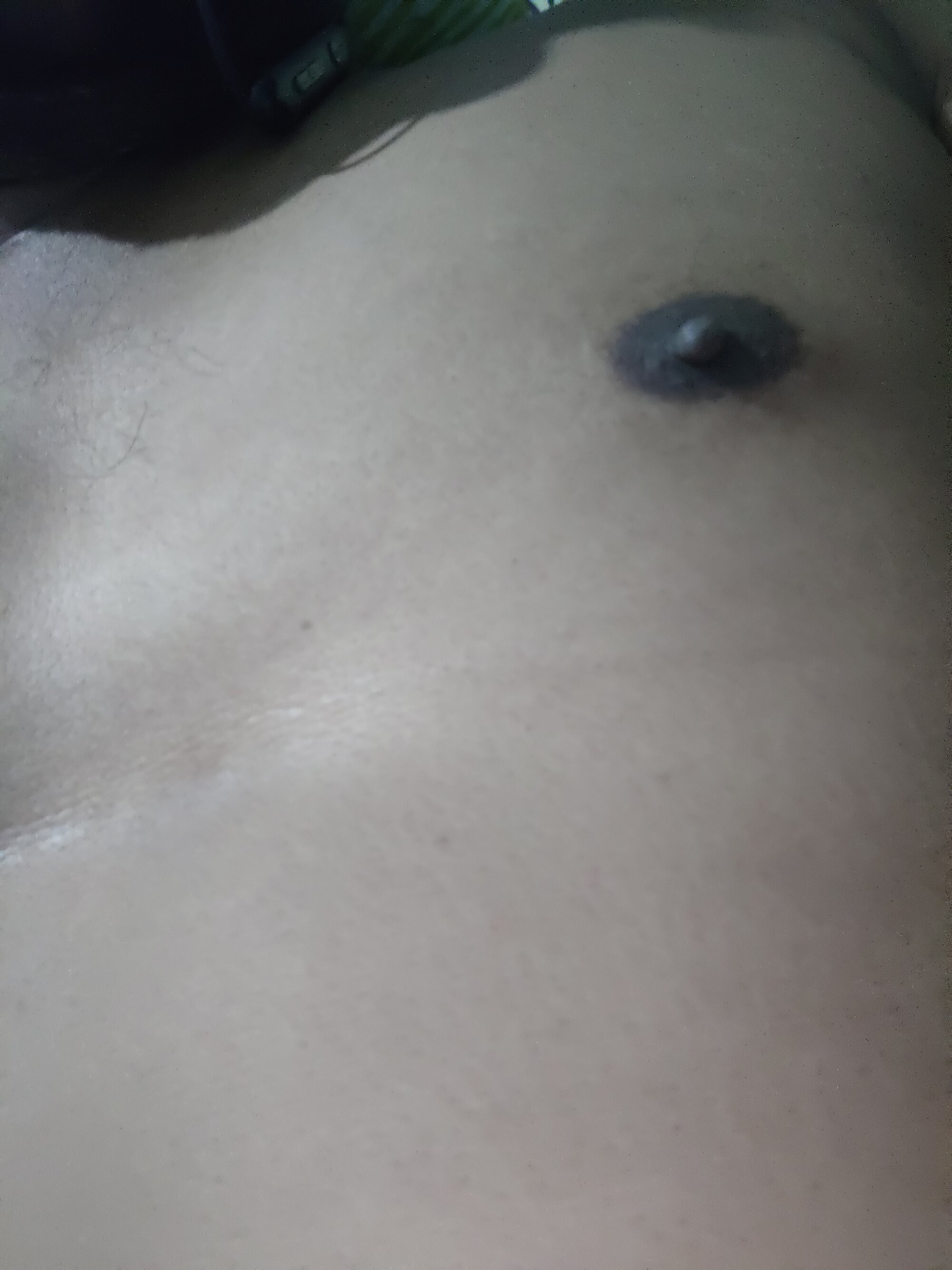 APVSC