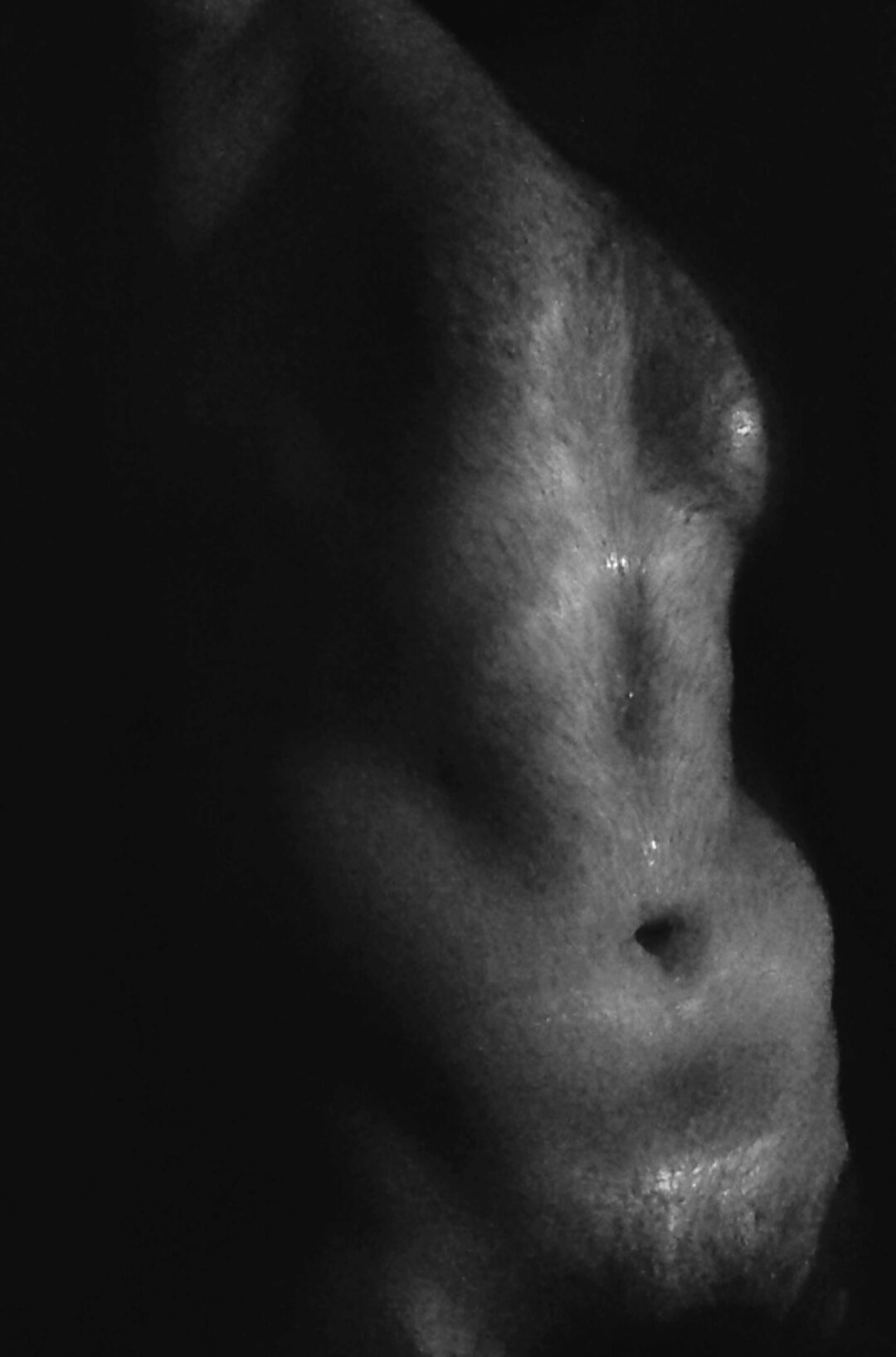 anhale1