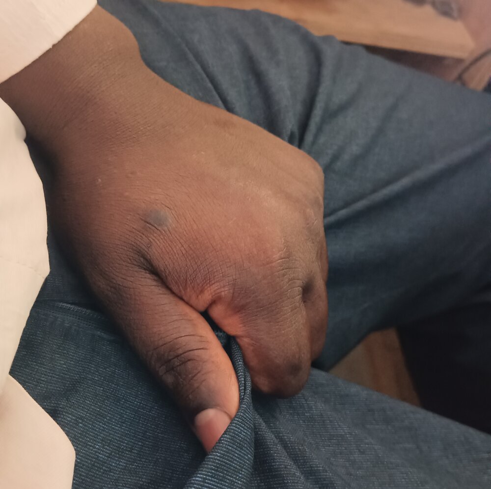 blackdick44