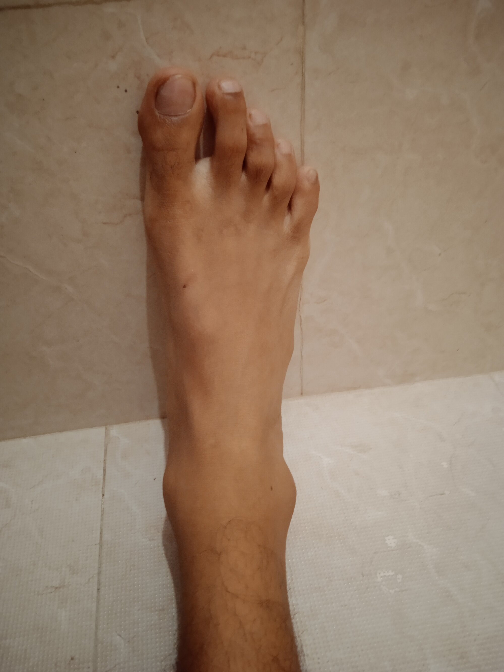Anesh_143