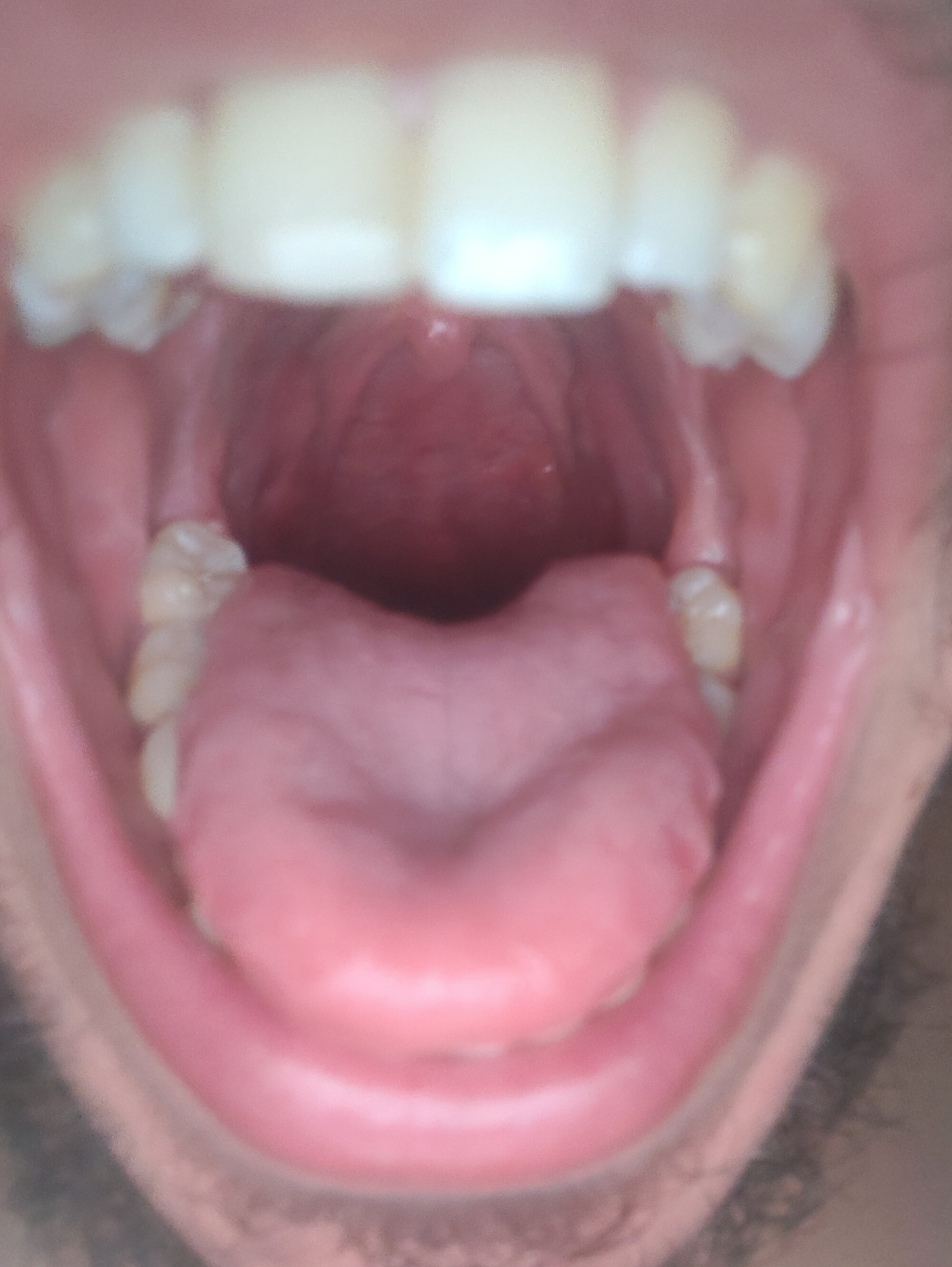 ga_ma98