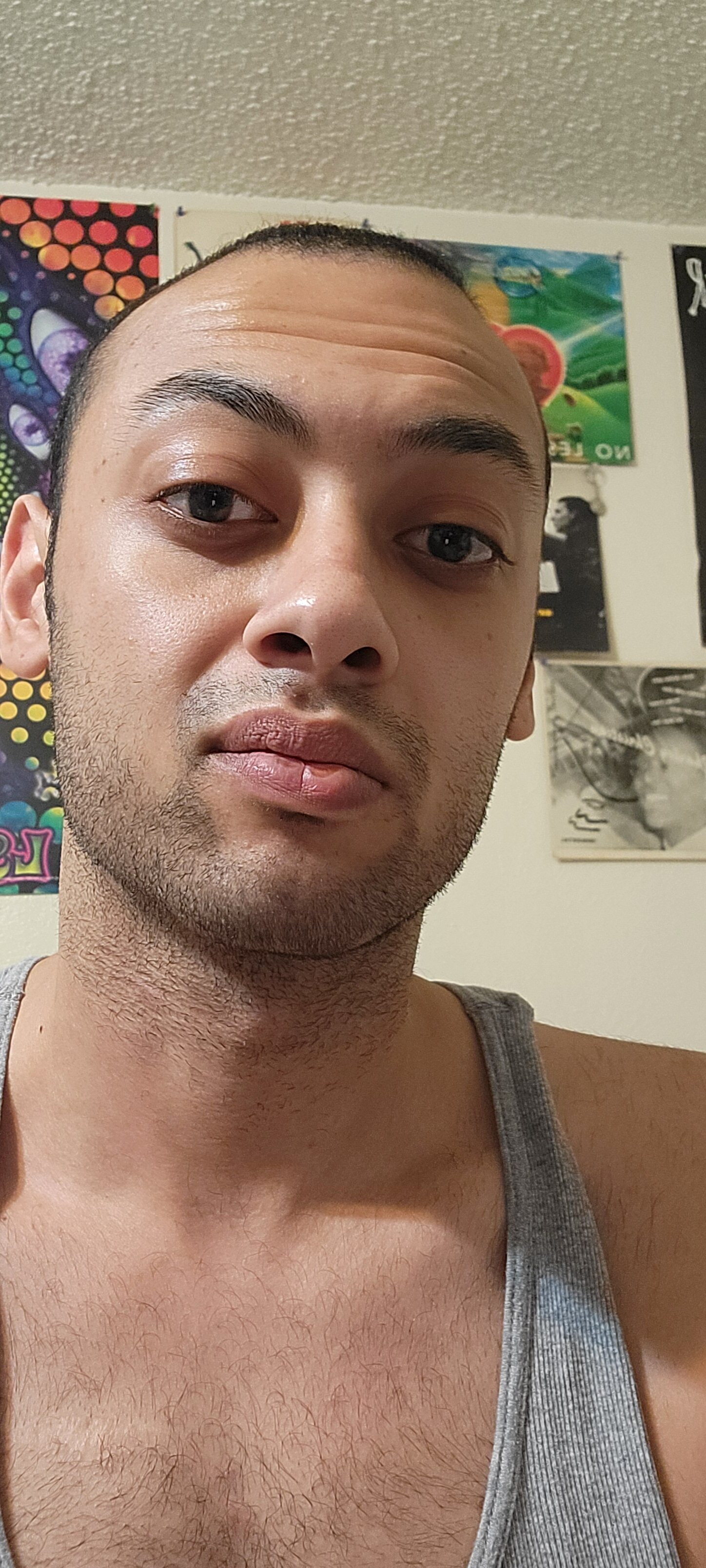 Icytoez