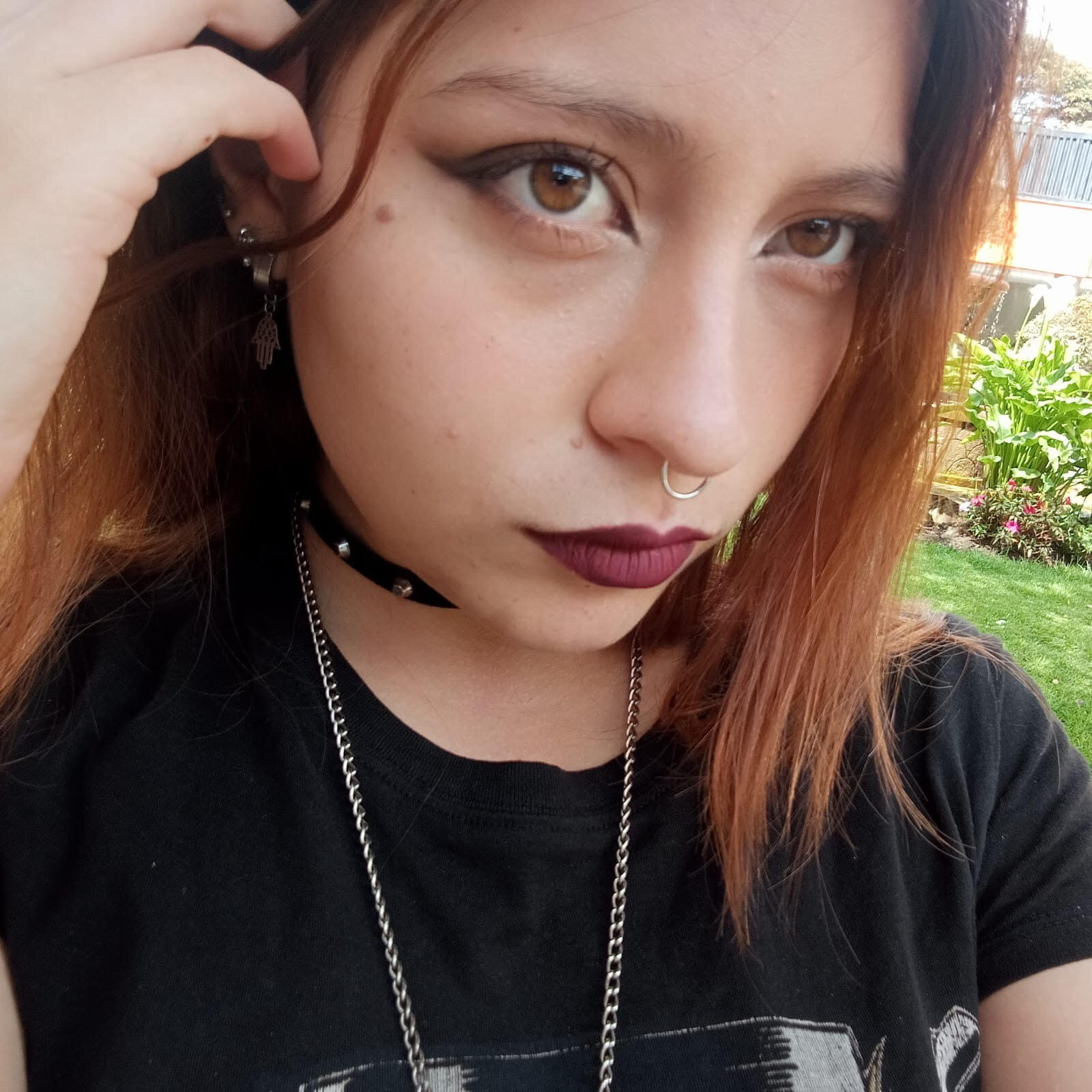 Fox_freckles