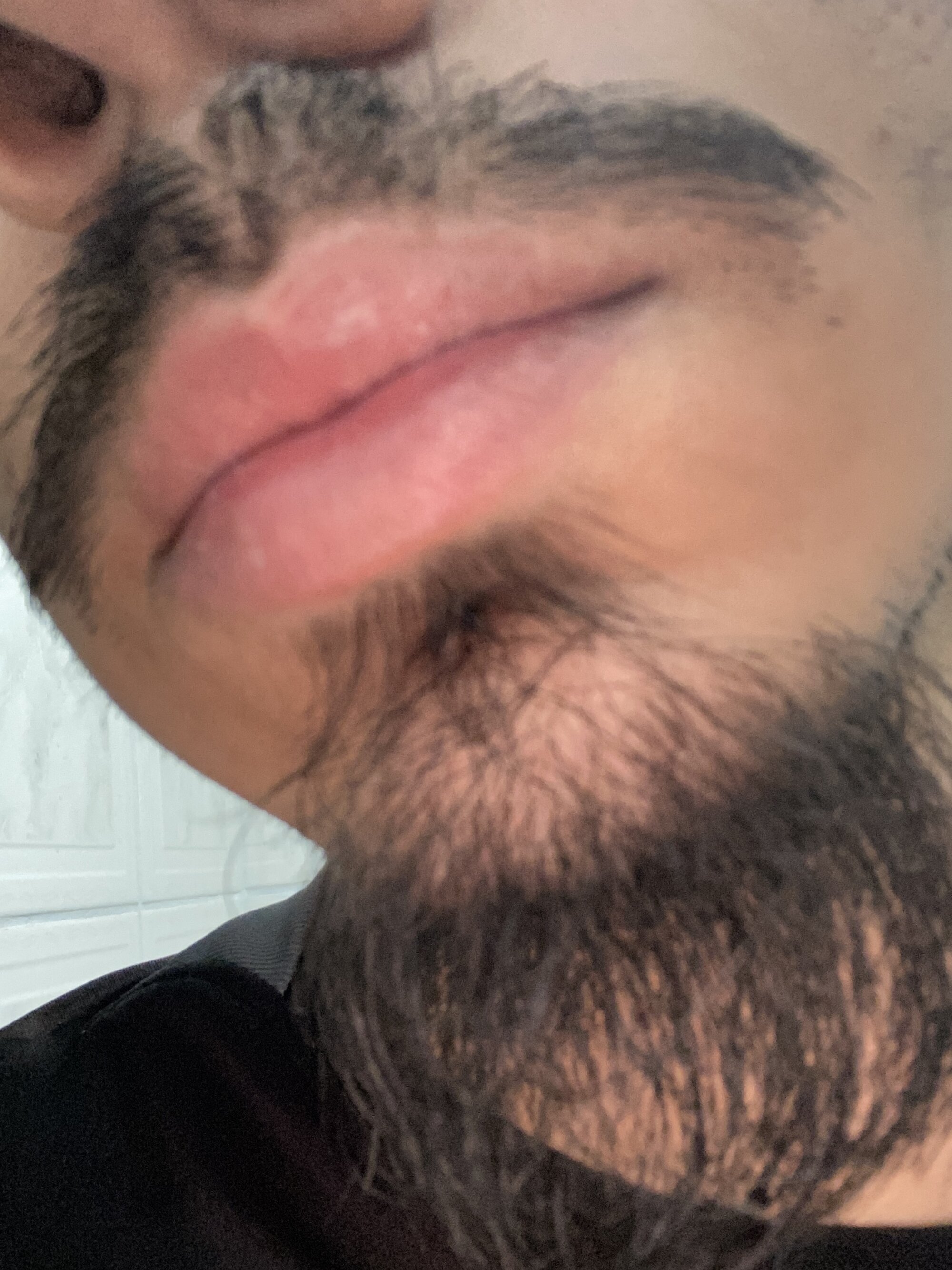 pirocagost