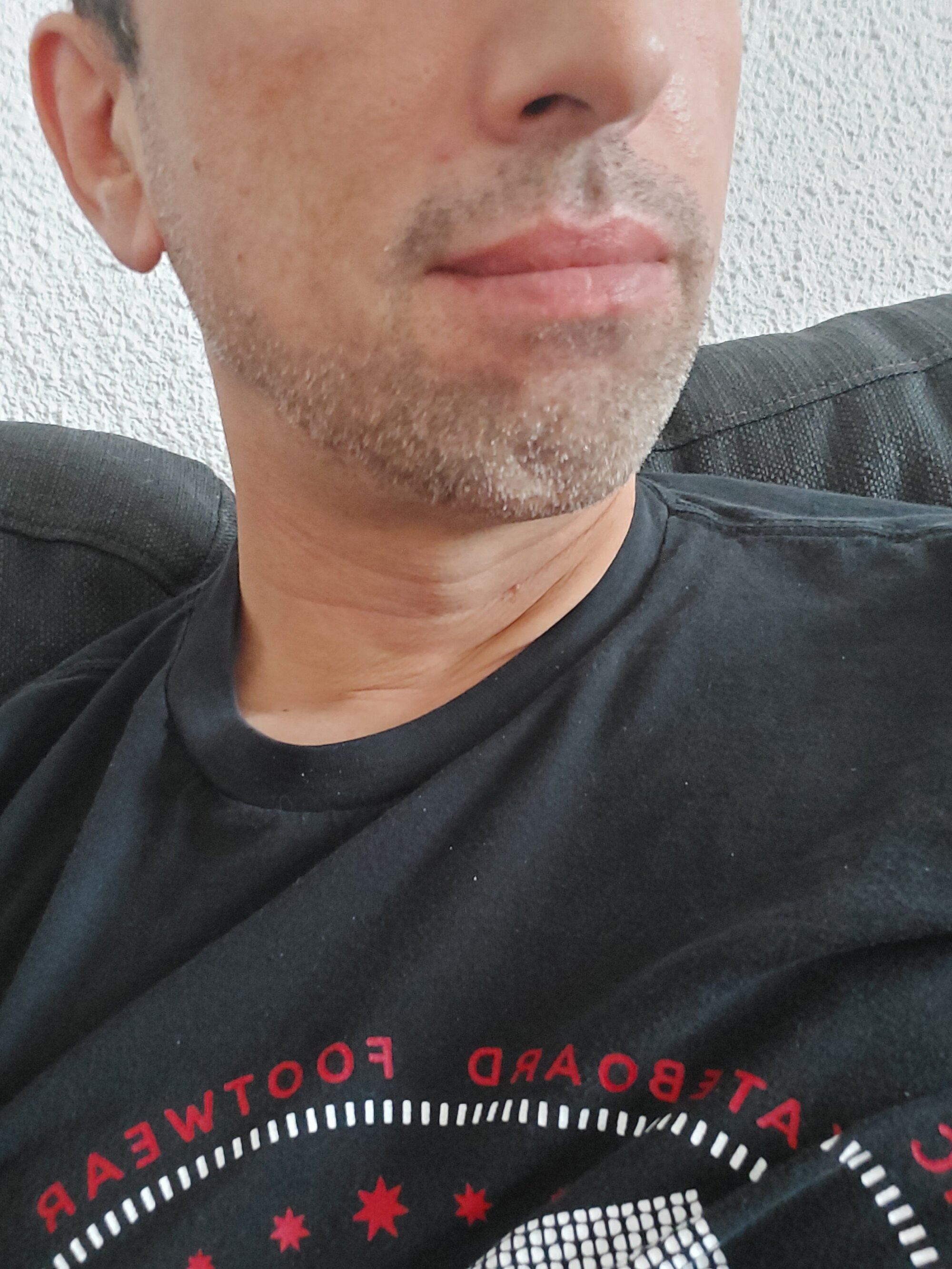 kidieg