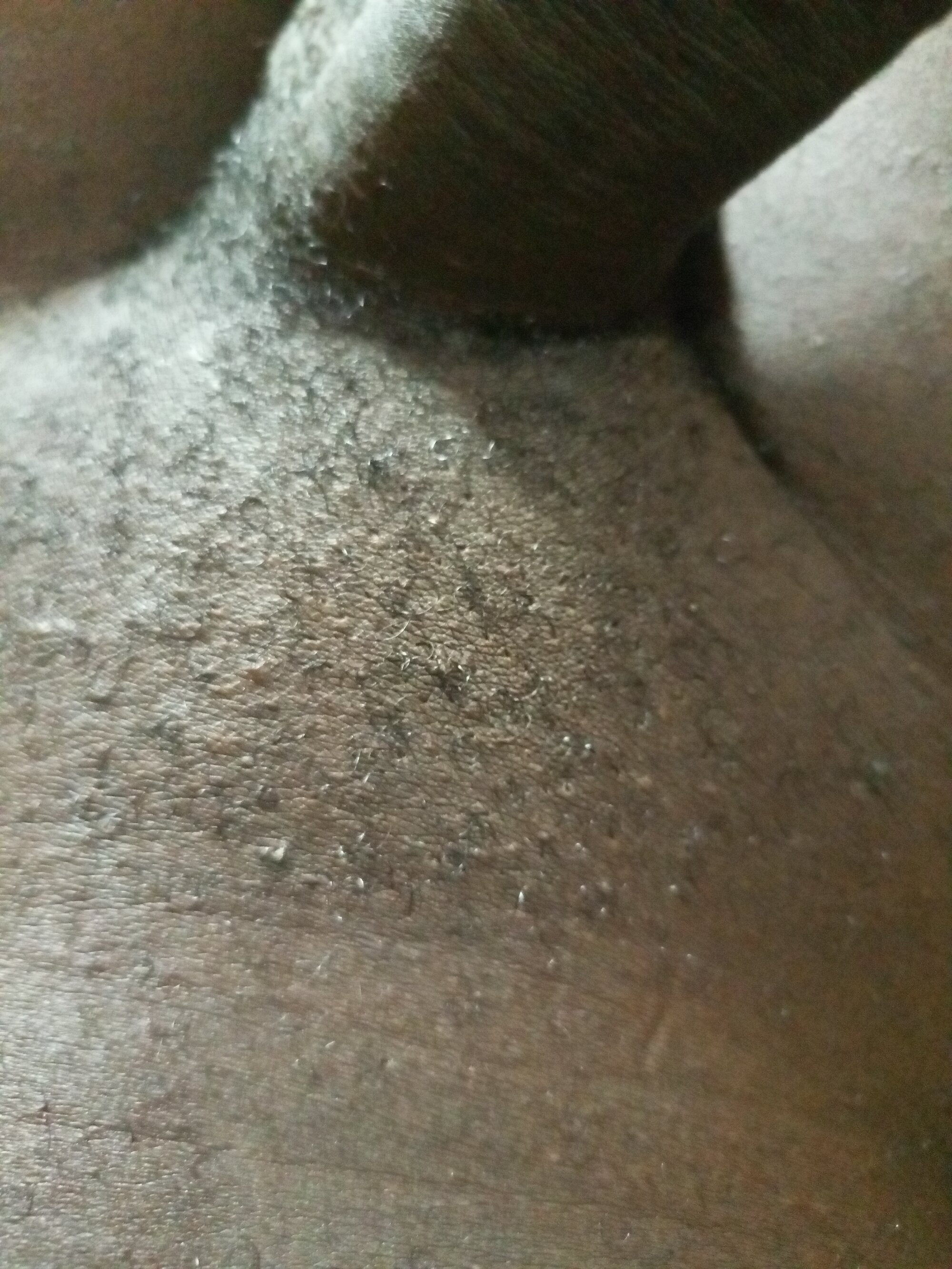 Dicky25curved