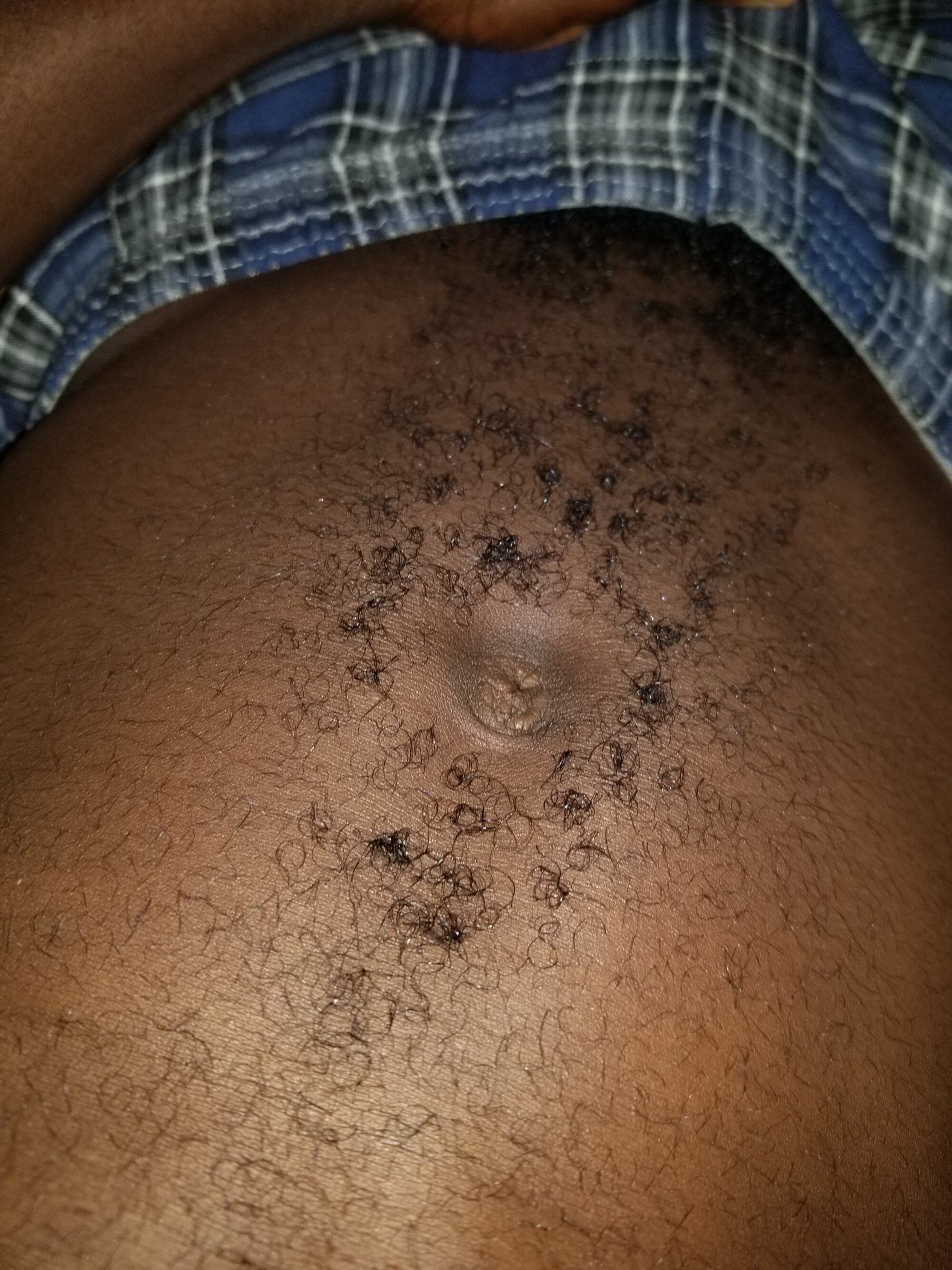 cedblaq
