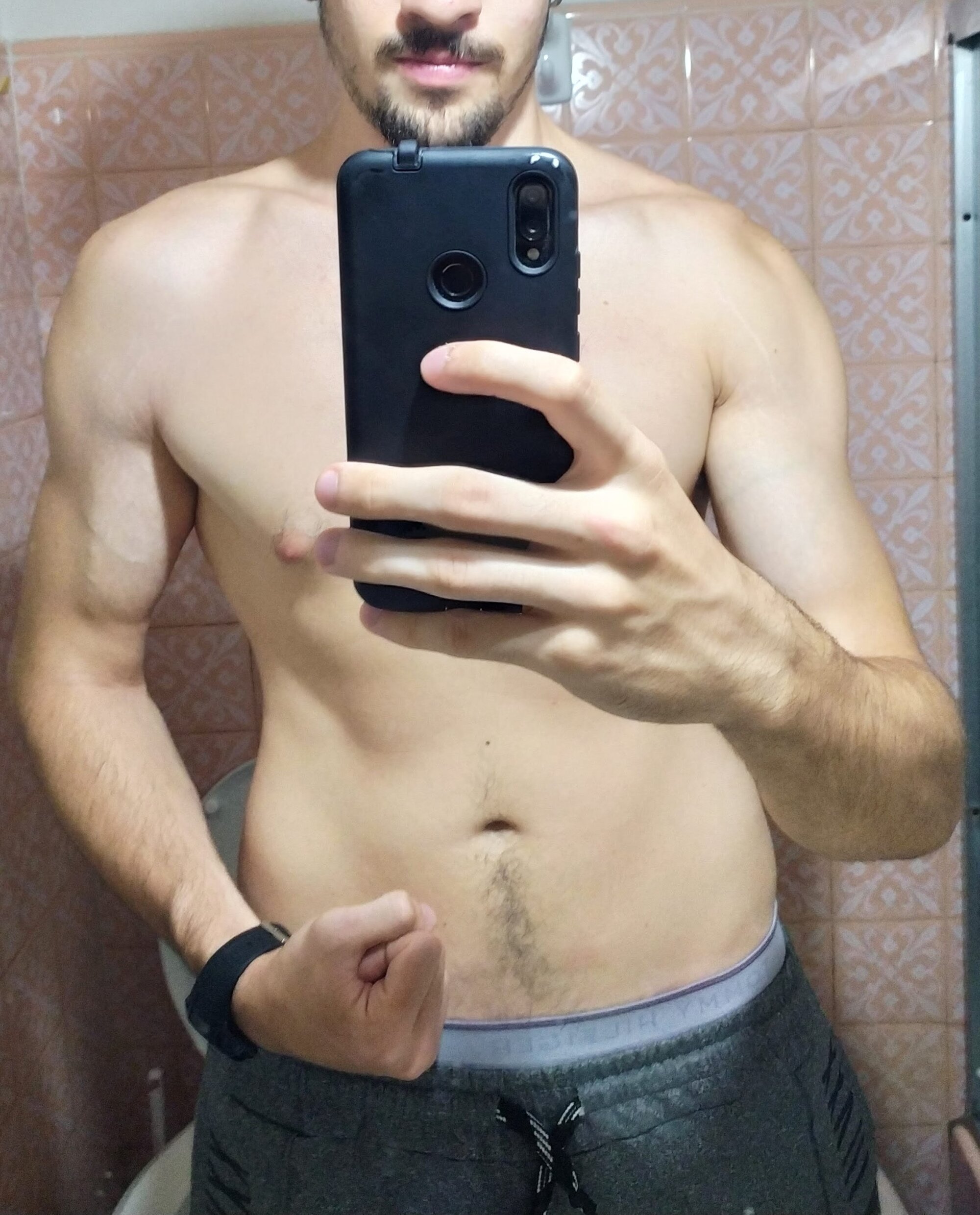 Pichurra77