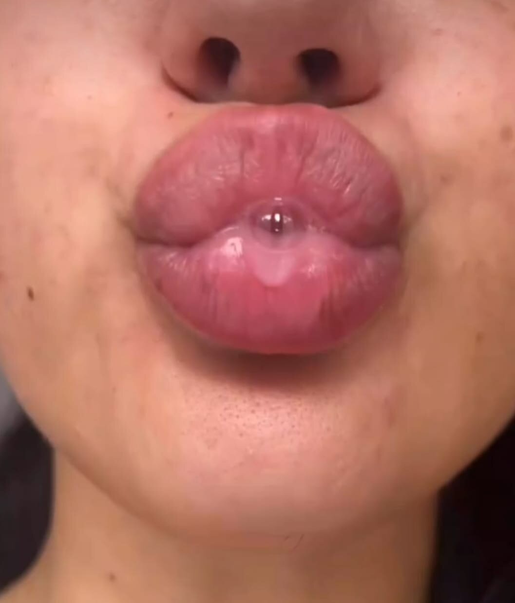 -Layali
