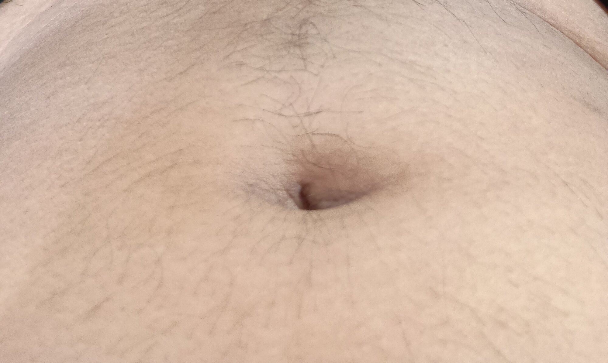 mallu99