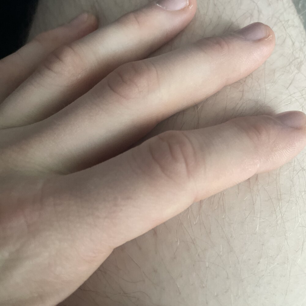 MeGustaBene 오프라인 XXX 채팅