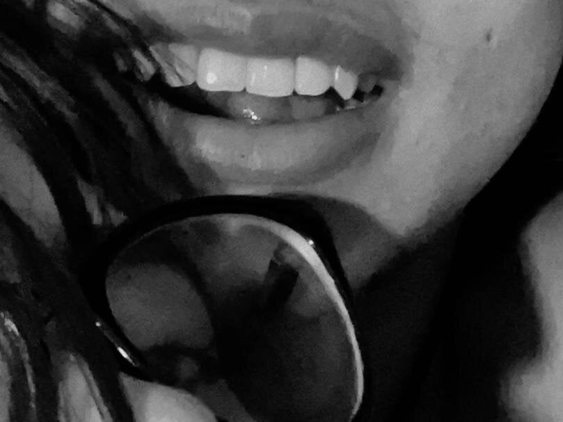 Exotic_couplex profile