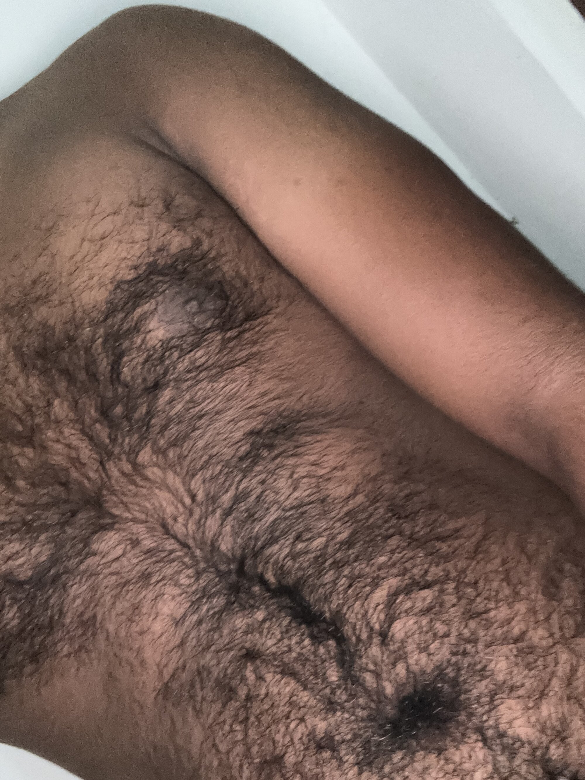 Rashxblackcock