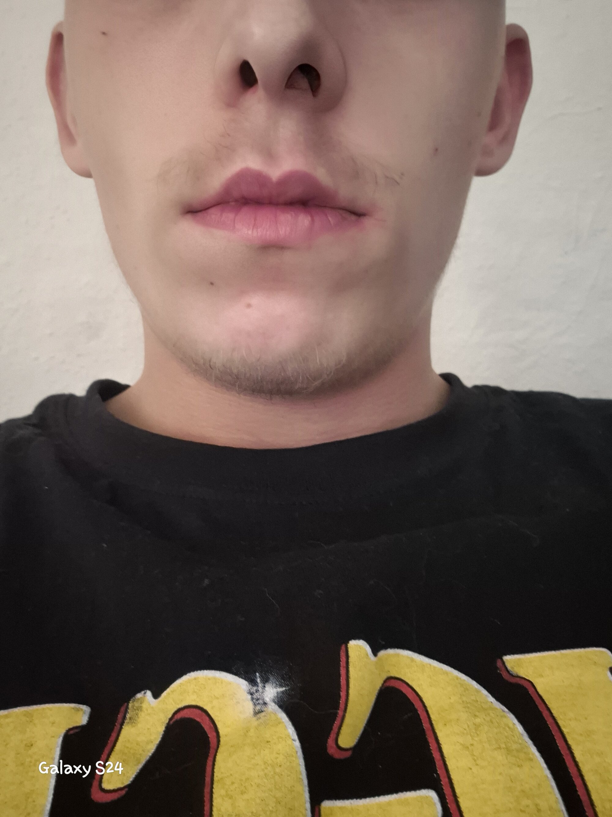 DerAlbino