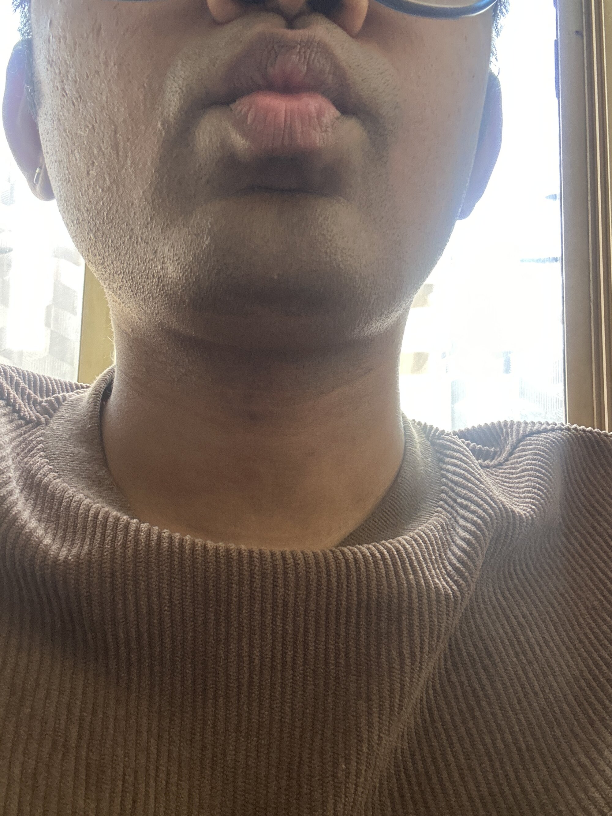 avinash005