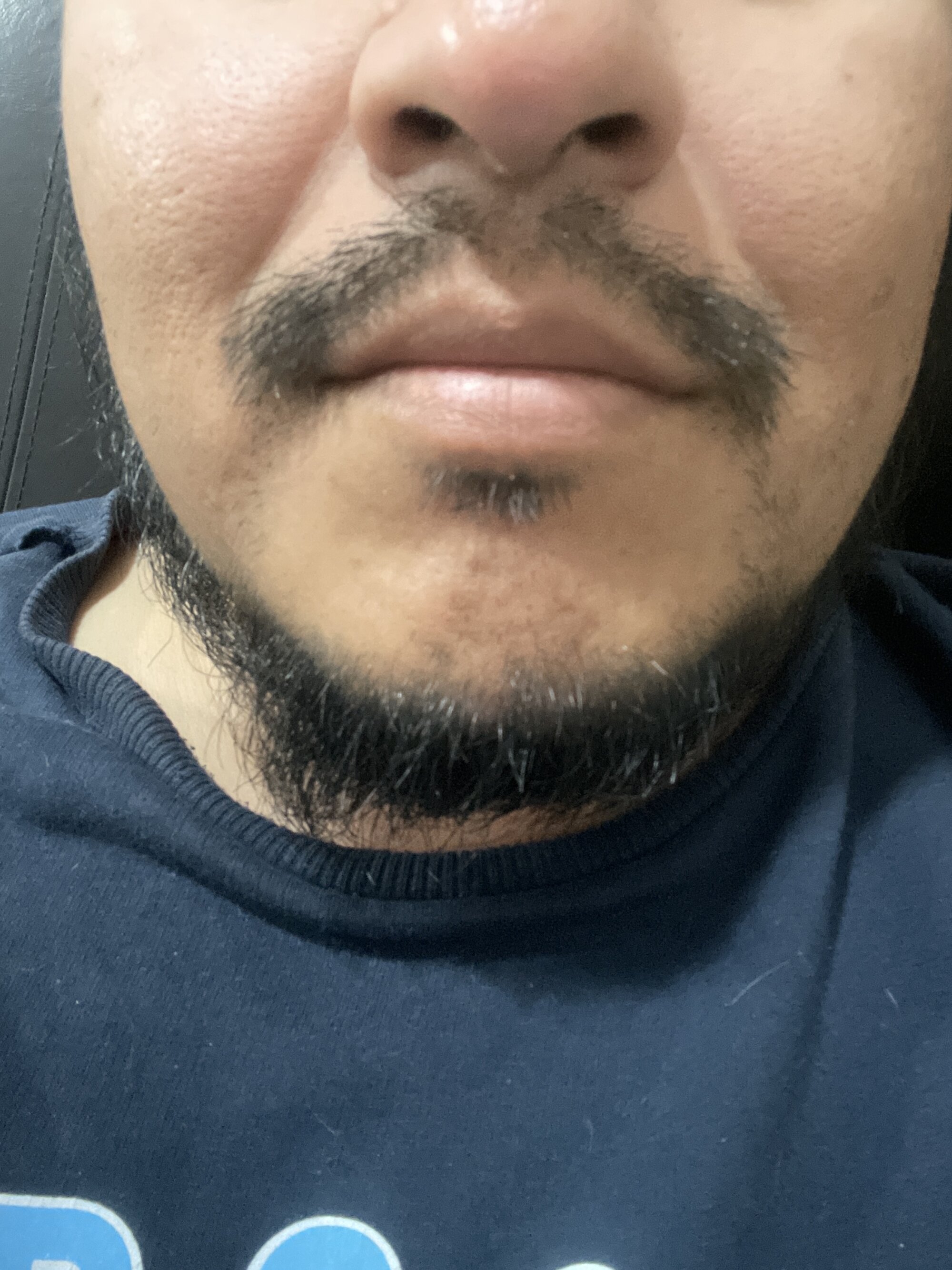 Miauricio