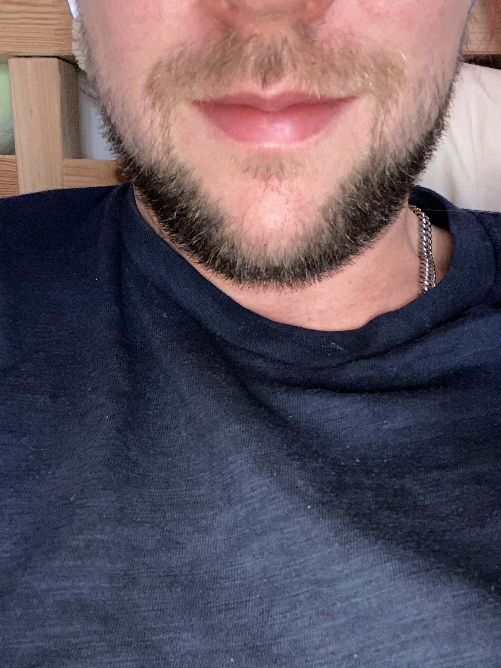 straight_-_Alex