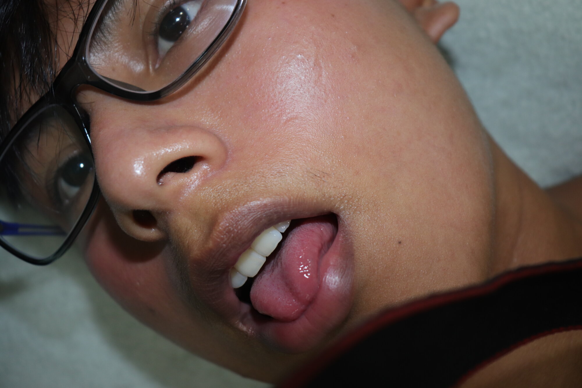 erixbl