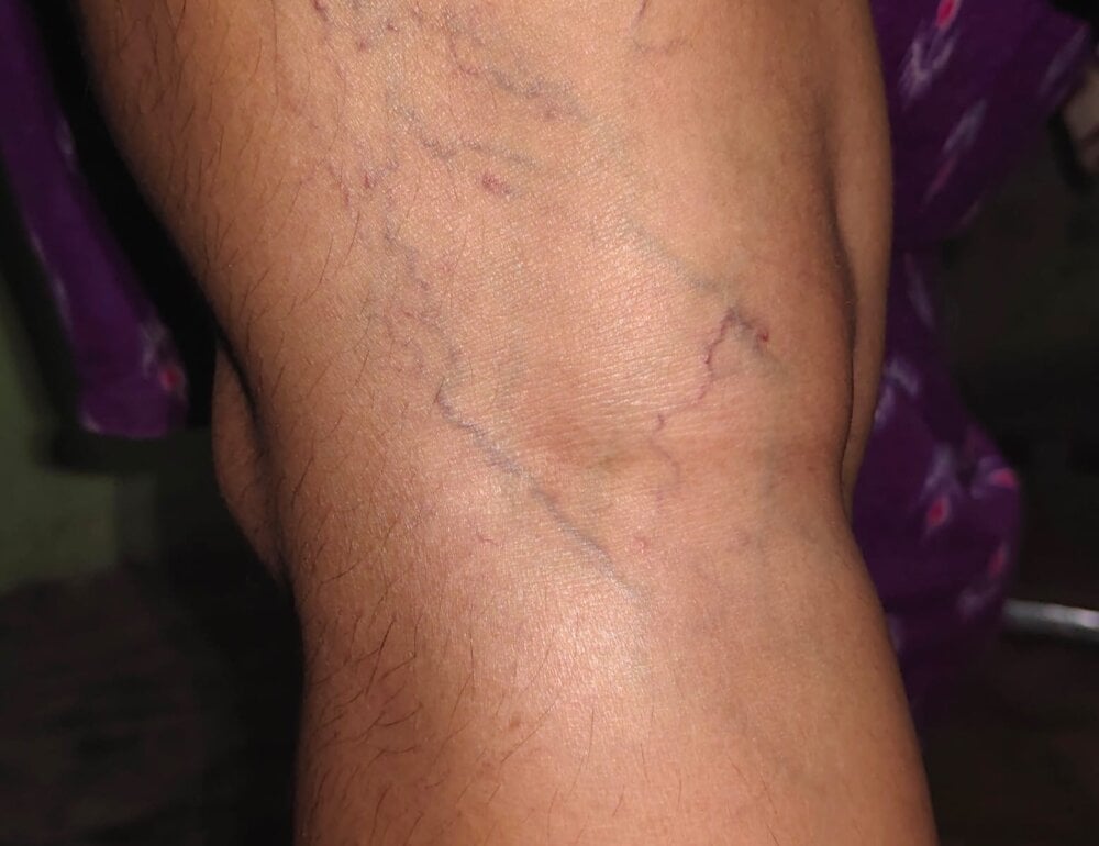 Chat XXX offline de Jyothisuraj