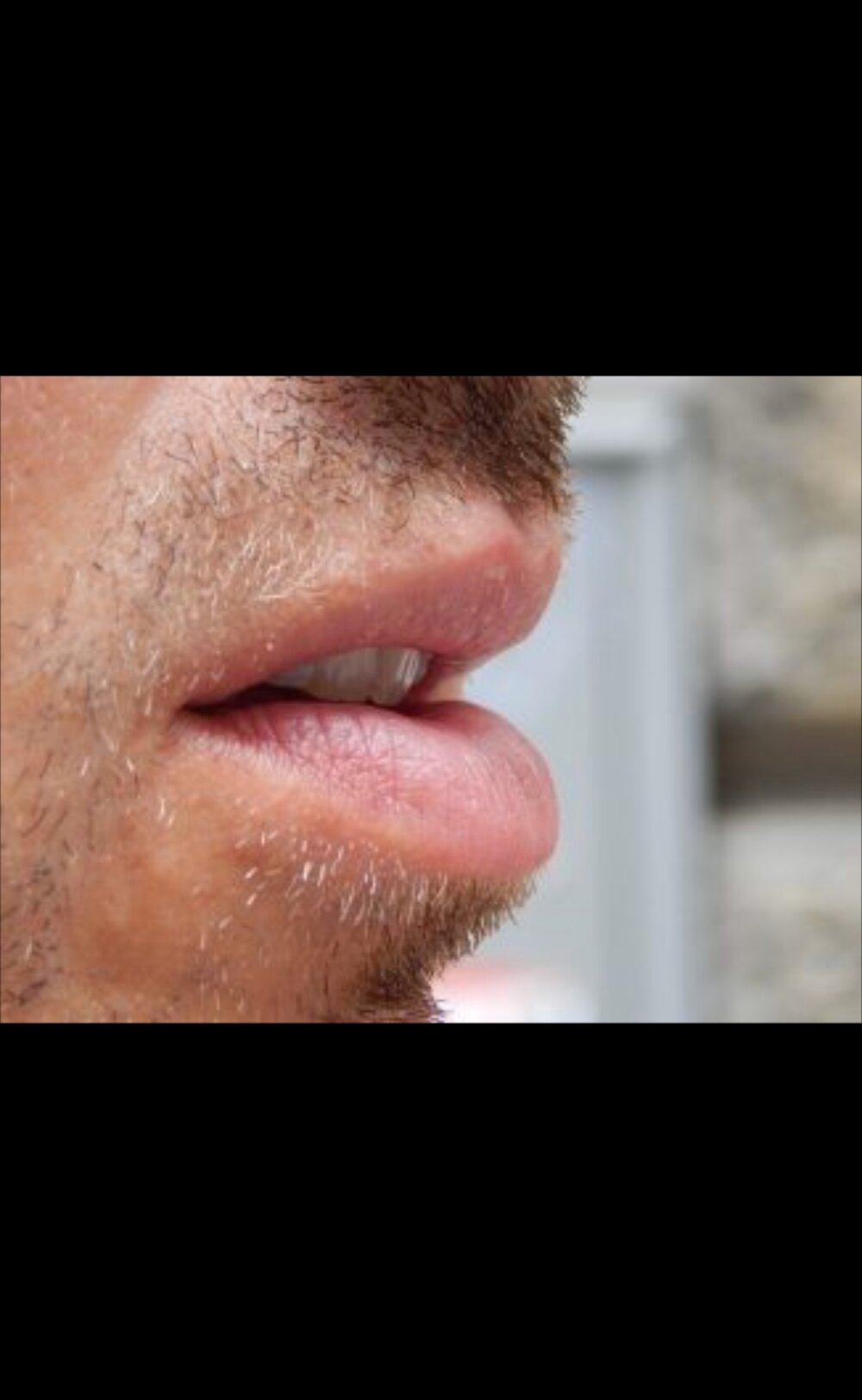 Kallobs profile
