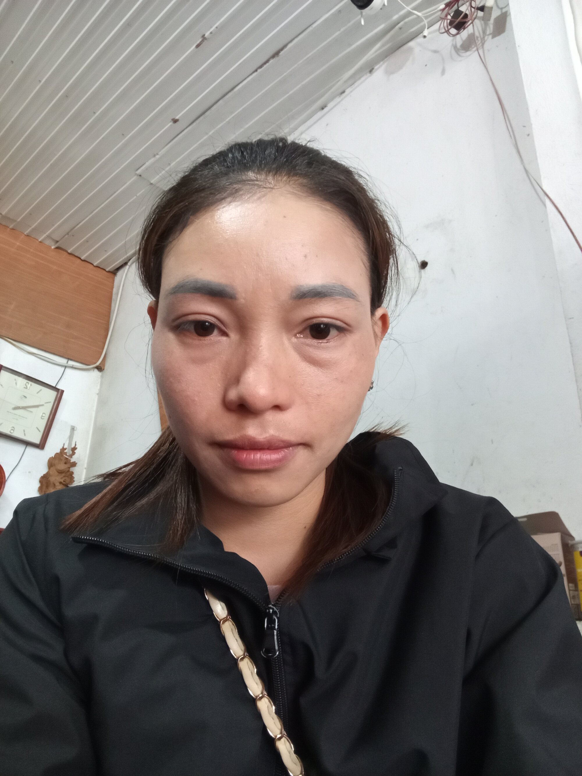 Ntpham
