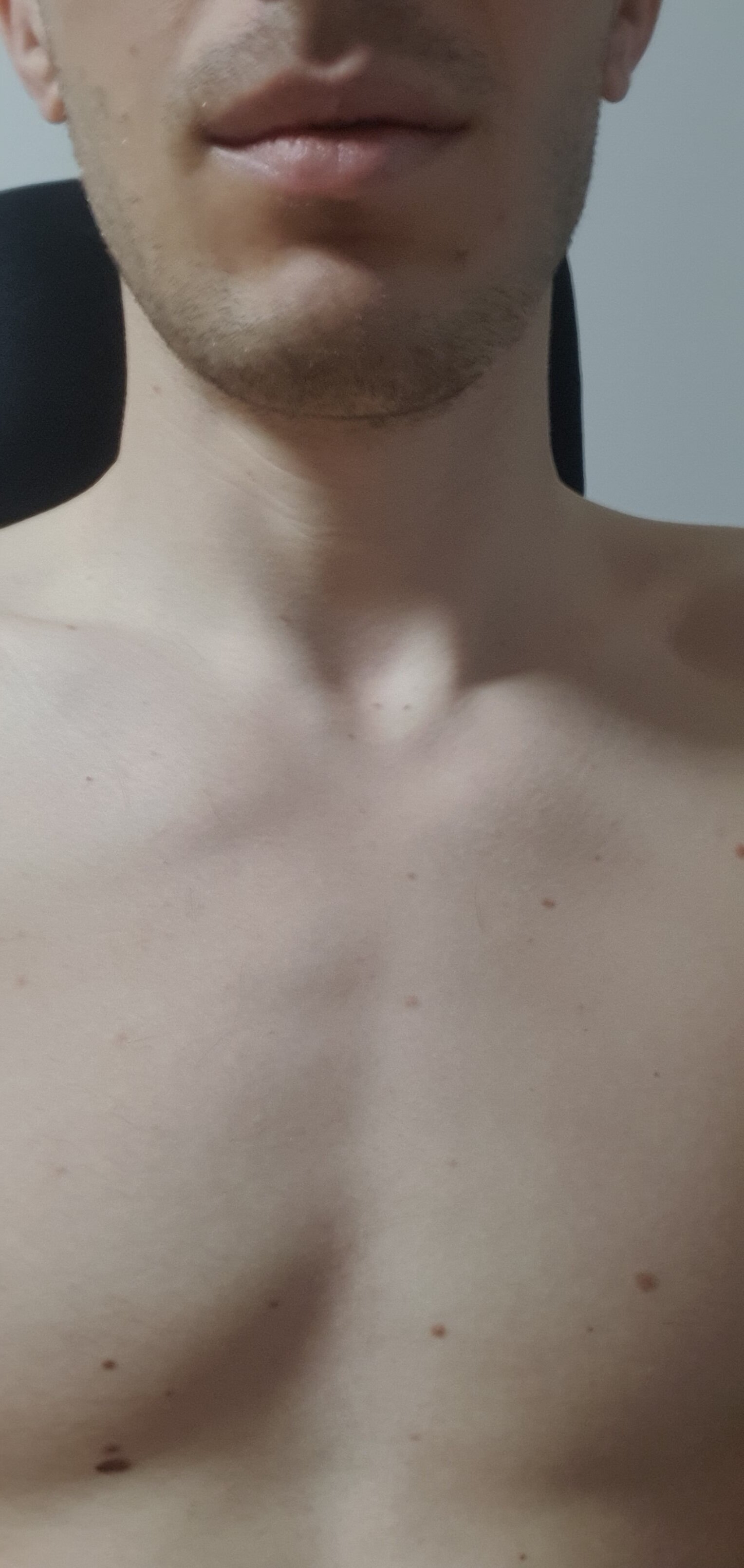 69this