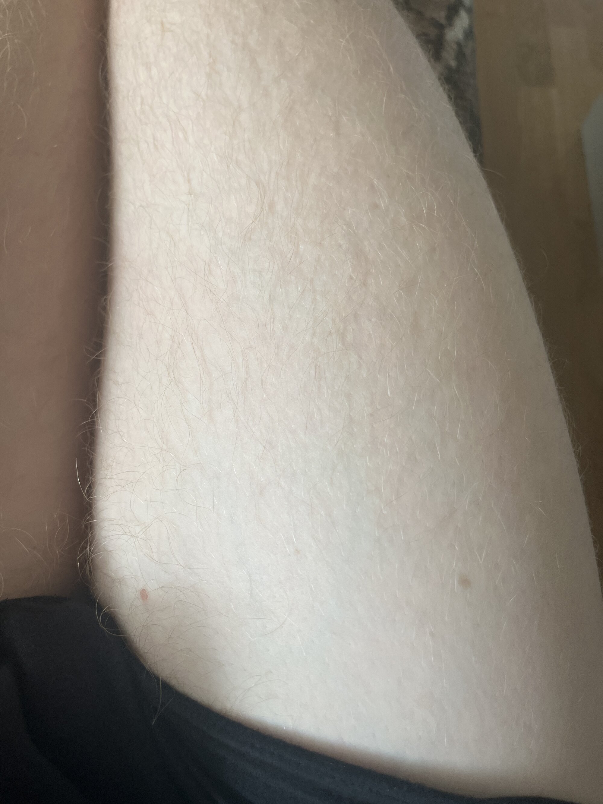 GER420x