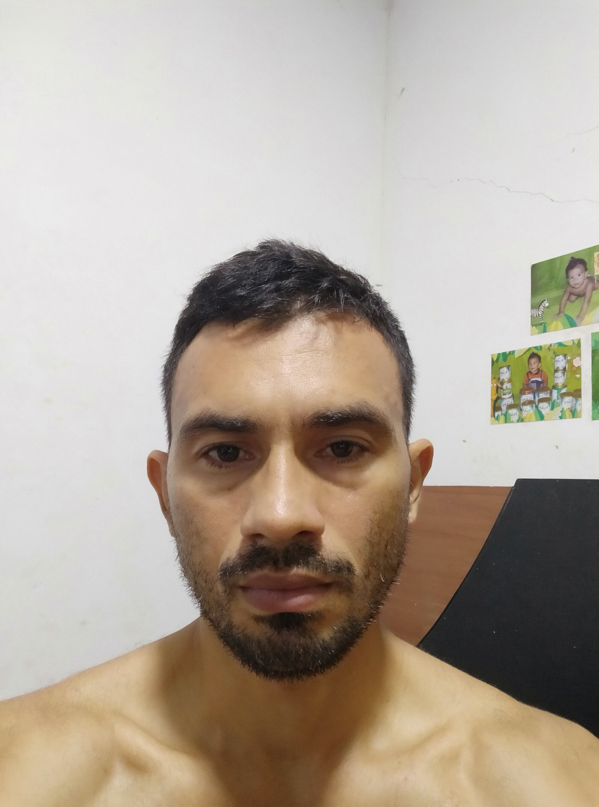 torote25
