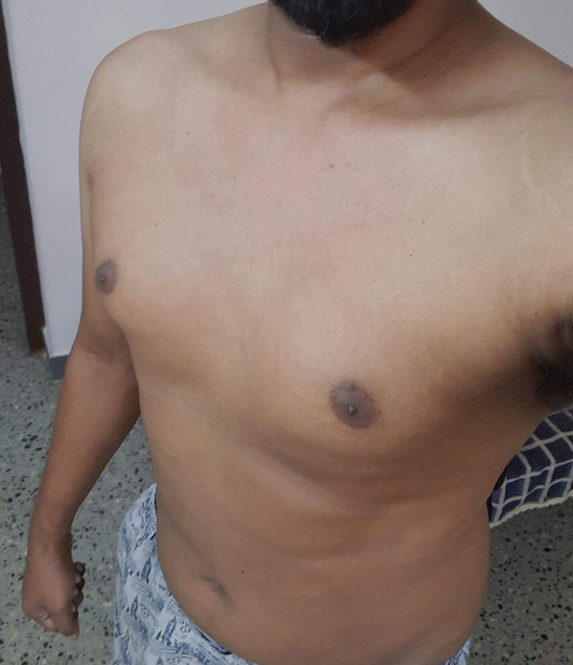 Rohitsacharya