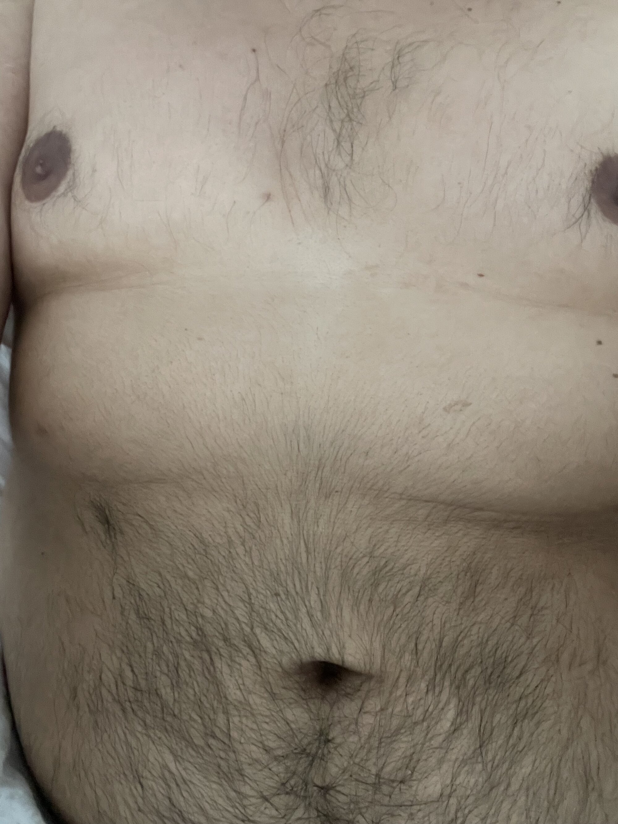 Moy27m
