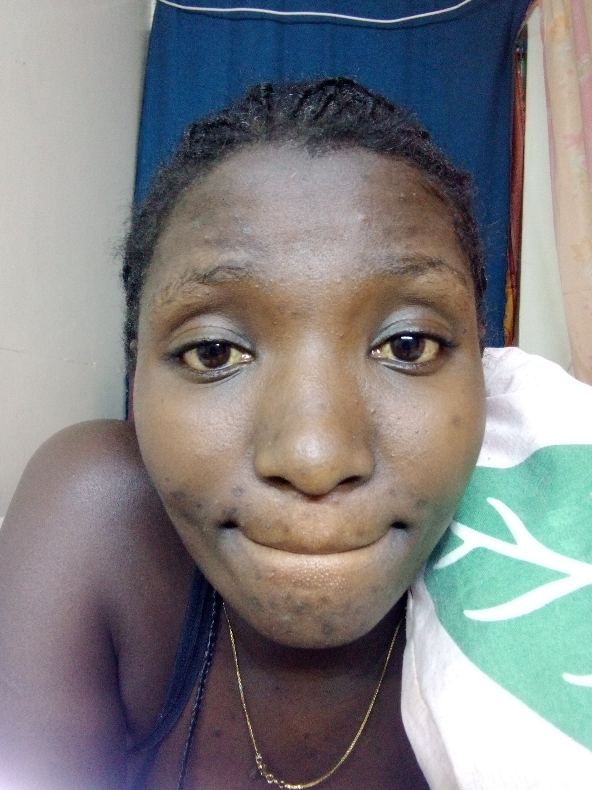 Hope_benta