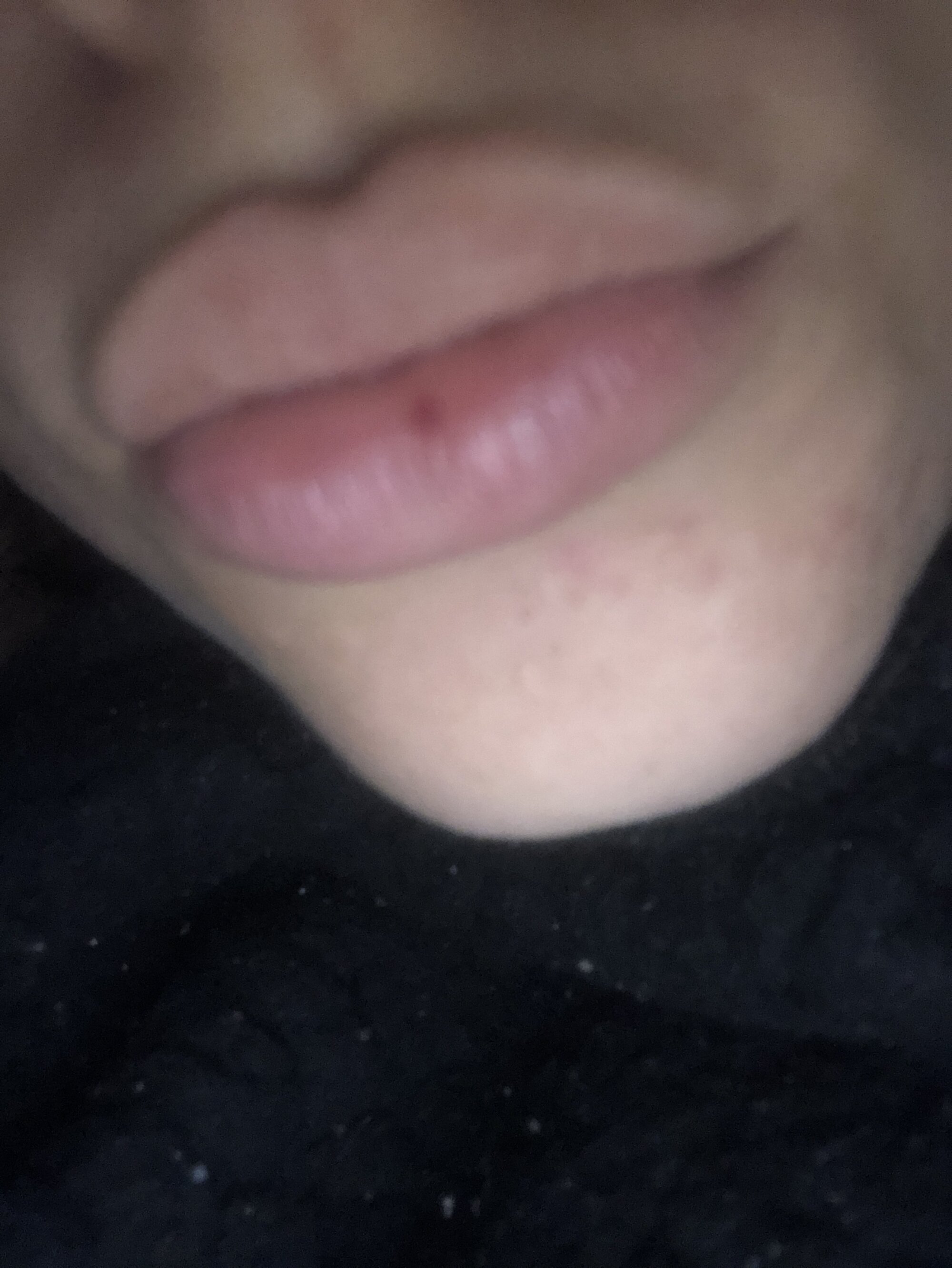 gatadosite