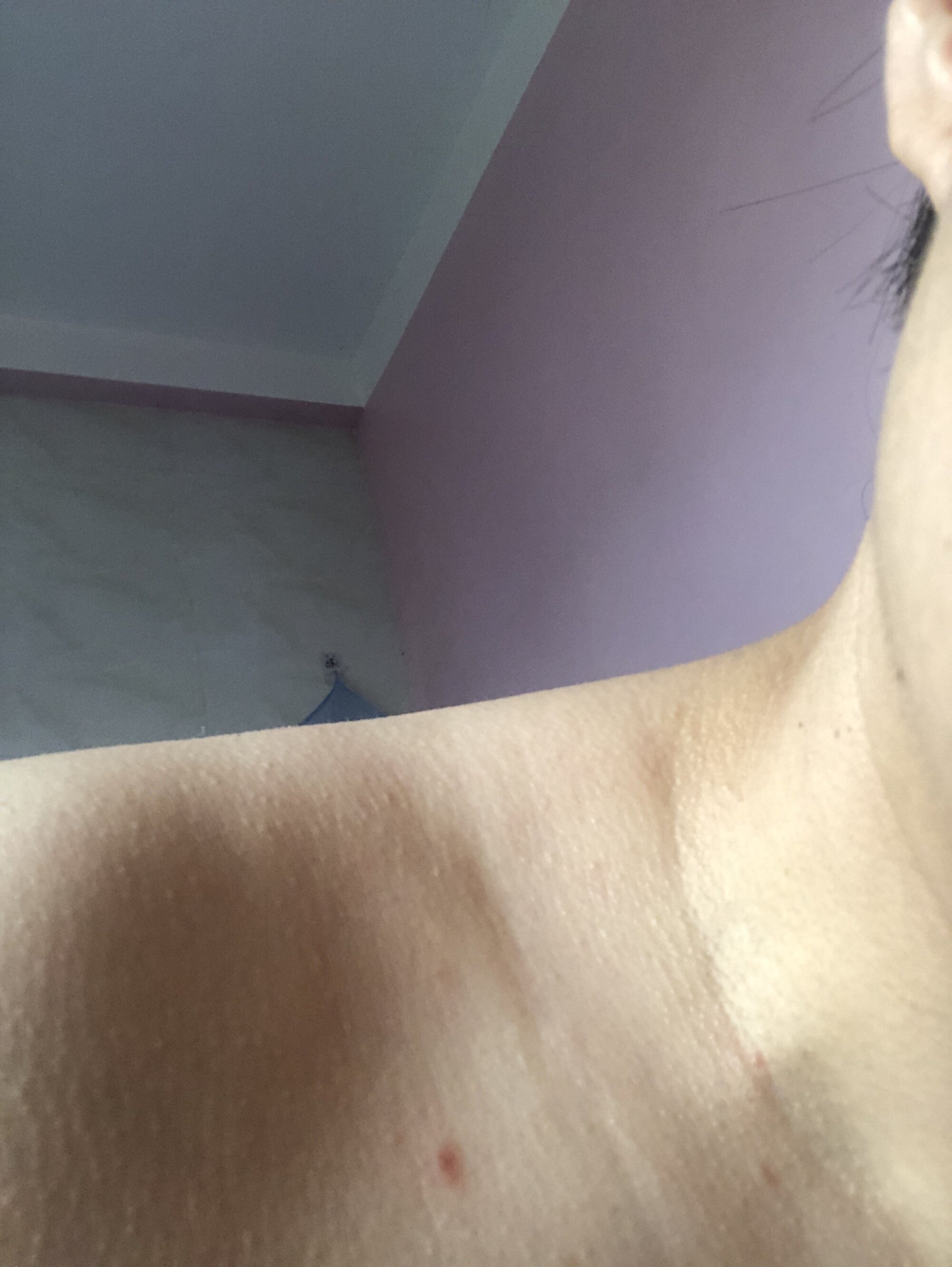 Ppck135