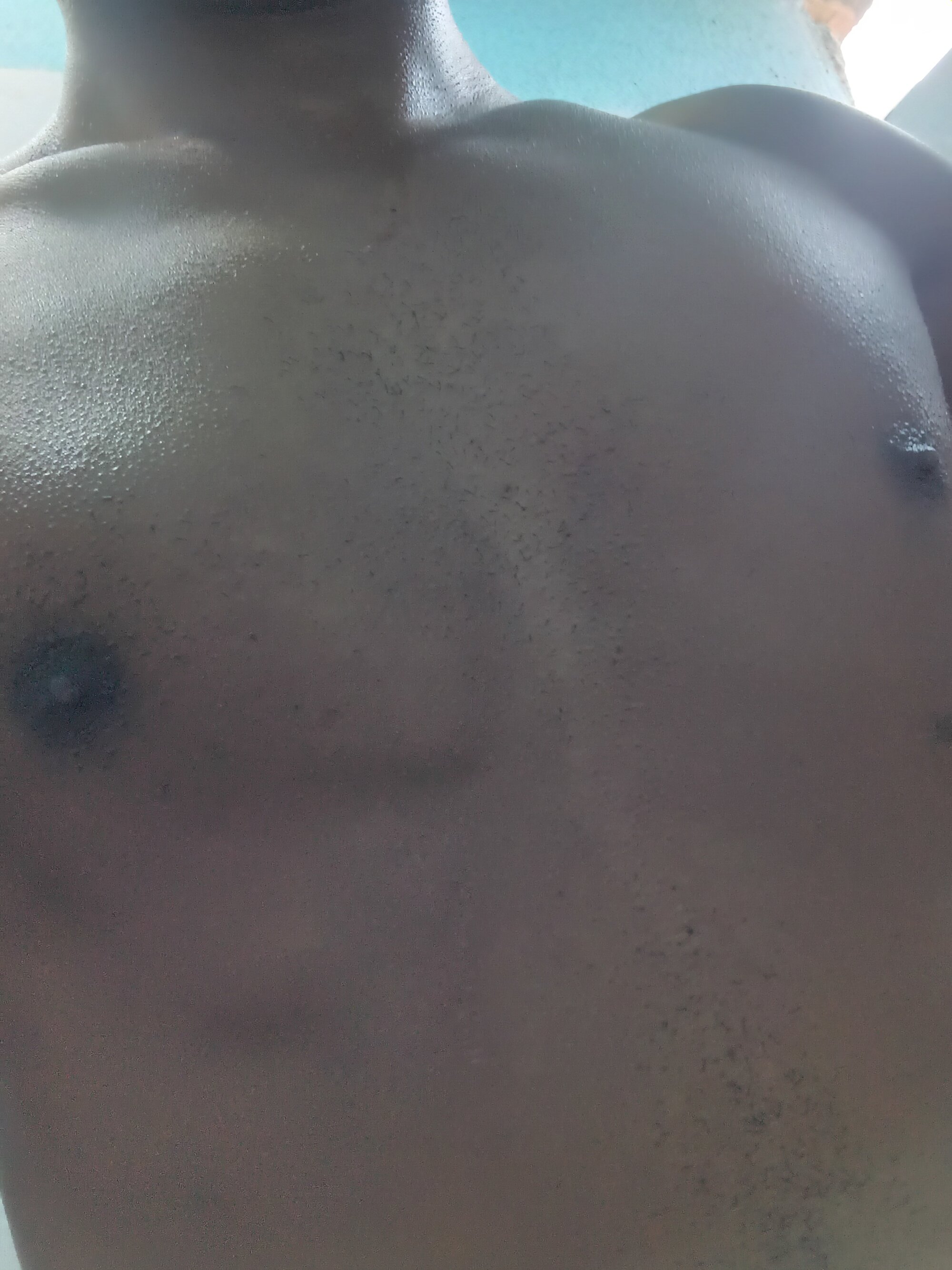 elflaco102