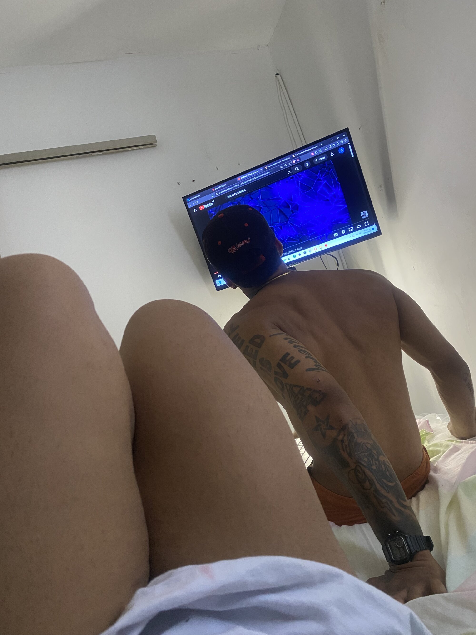 AxelandScar