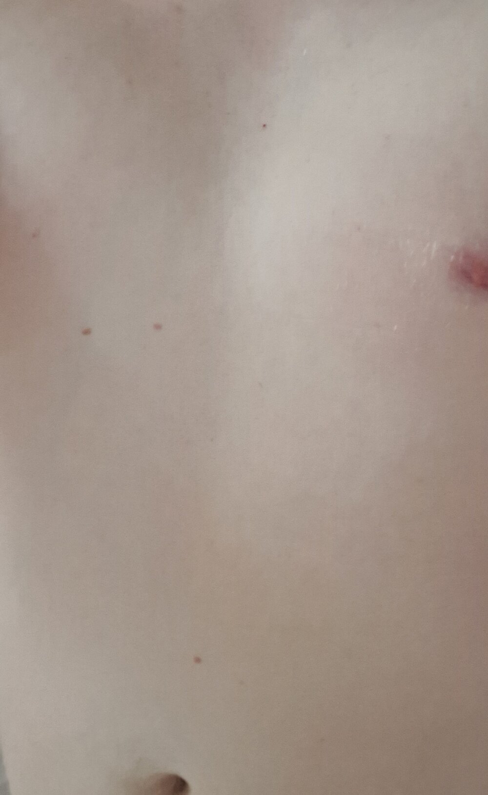 Longus_ profile
