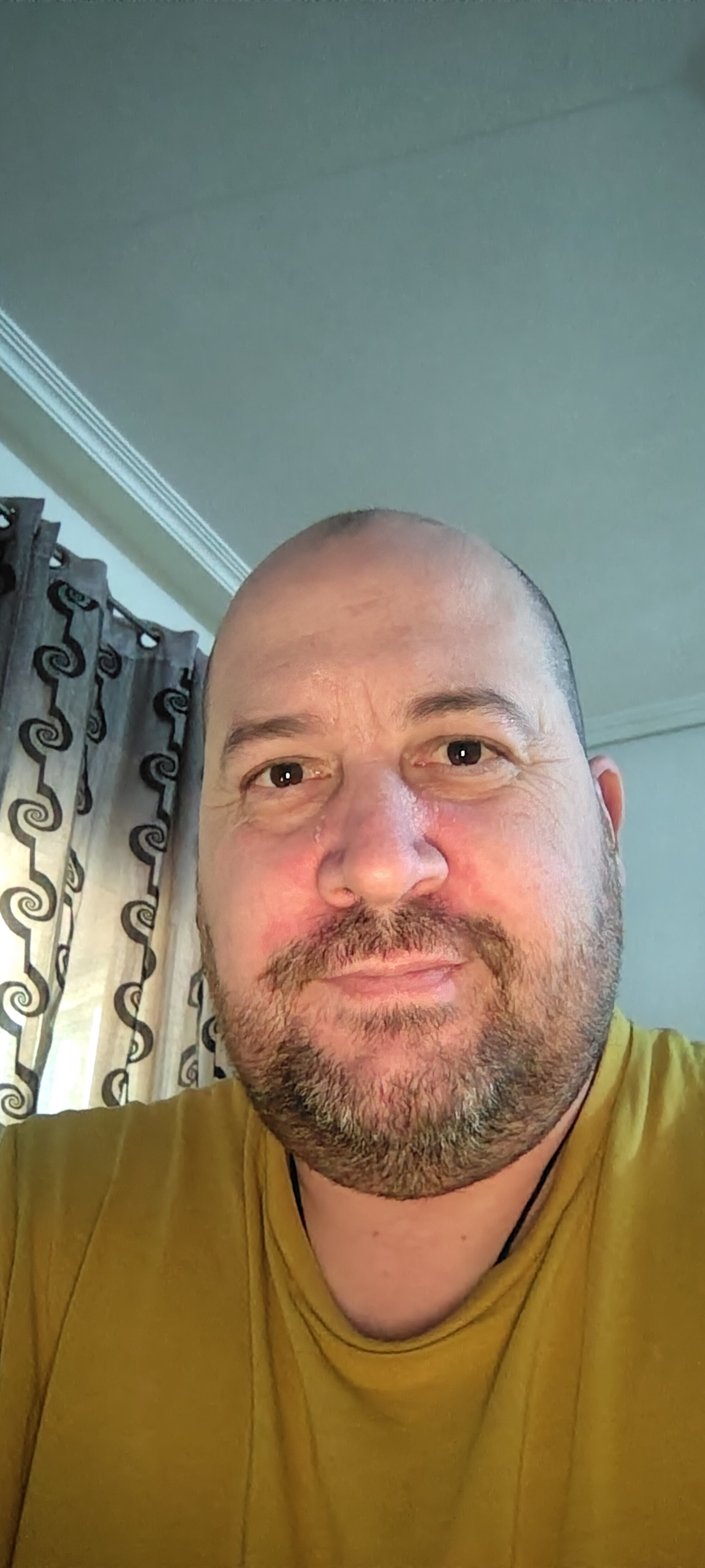 Ximo81