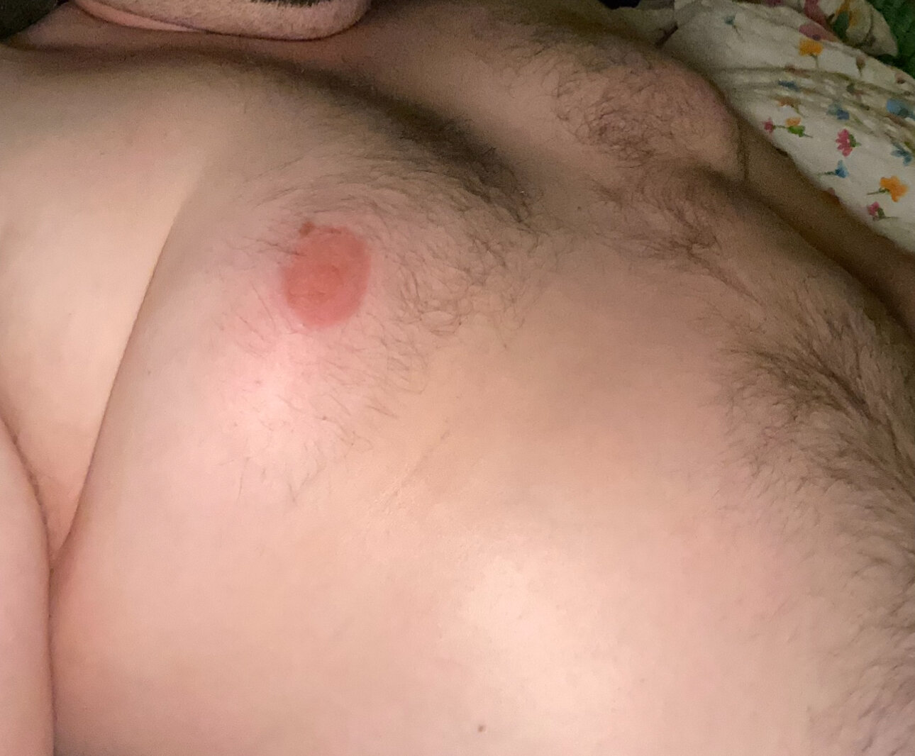 fatchubbynurse