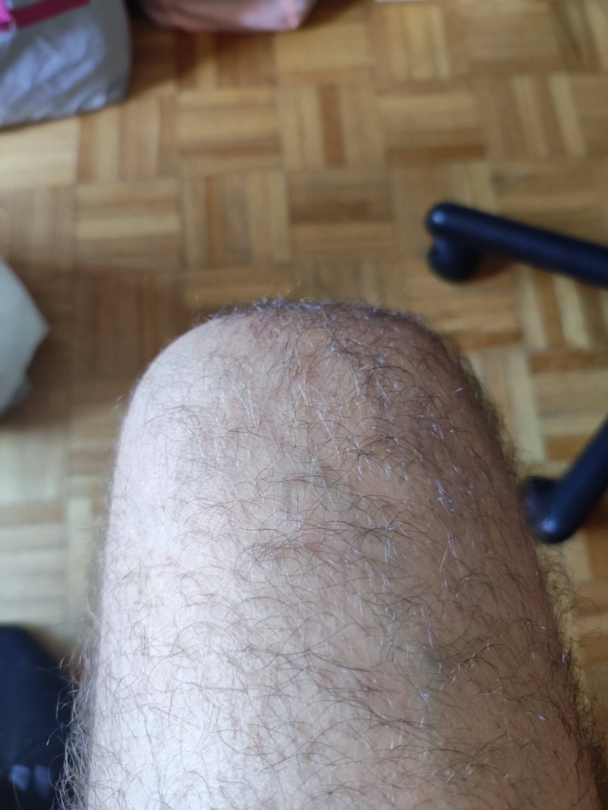pingodoce25