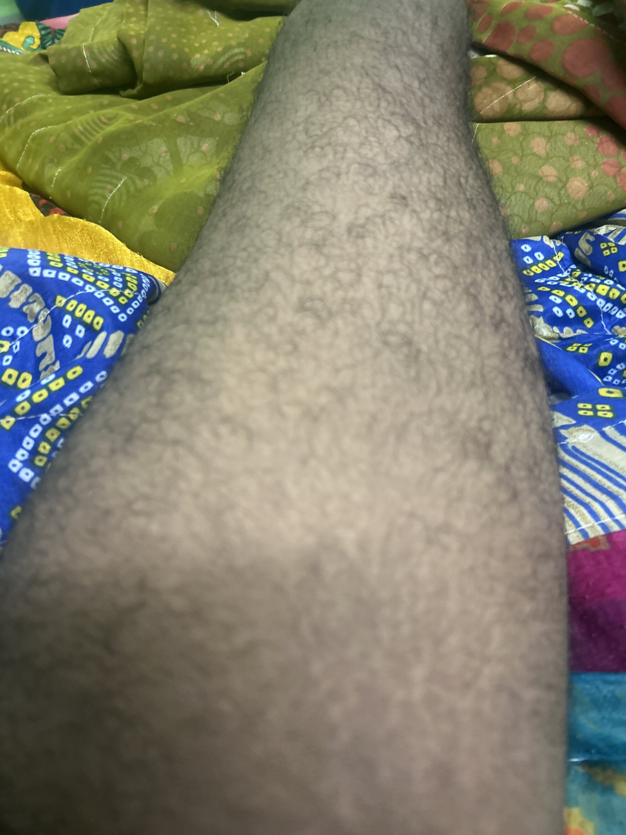 pukunakuthaHyd